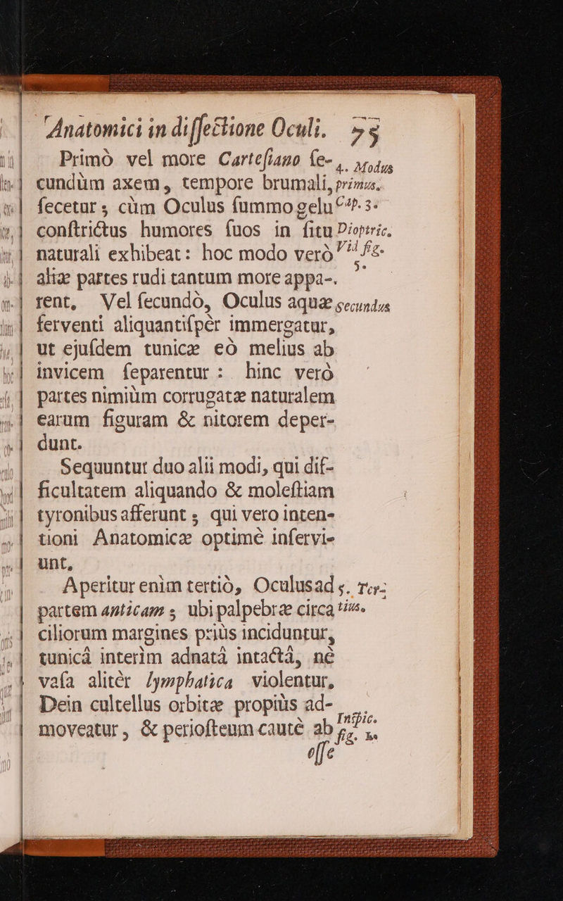                              Ánatomici in di [fetione Oculi. 7$ Primó vel more Cartefiano fe-,. is cundüm axem, tempore brumali, prima. fecetür ; cüm Oculus fummo gelu ^^ s conftri&amp;tus humores íuos in fitu Dioriric, naturali exhibeat: hoc modo veró pum aliz partes rudi tantum moreappa-. ' rent, Velíecundó, Oculus aqua eunt ferventi aliquantifpér immergatur, ut ejufdem tunice eo melius ab invicem feparentur : hinc veró partes nimium corrugatz naturalem earum figuram &amp; nitorem deper- dunt. Sequuntur duo alii modi, qui dif- ficultatem aliquando &amp; moleftiam tyronibusafferunt ; qui vero inten- toni Anatomice optime infervie unt, Aperitur enim tertió, Oculusad ;. ry partem 49ticap s. ubi palpebrze circa ti^. ciliorum margines pziüs inciduntur, tunicà interim adnatà intactá, ne vaía alitér /ymphata violentur, Dein cultellus orbite propius ad- — . moveatur, &amp; periofteum caute. ab E efe    