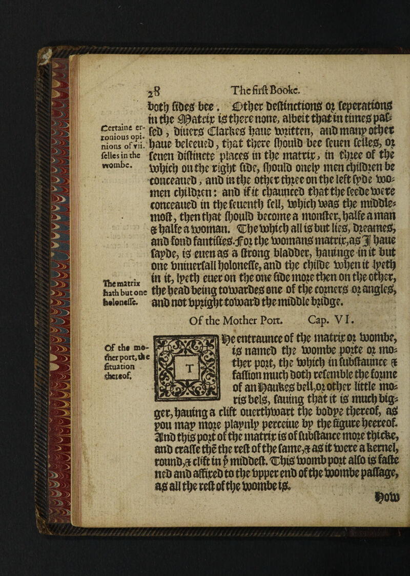 boti) ftdes bee. either befttnctiotis o? teperations in the gpatetr tstherenone, albeit that in times pafc CeT‘.ntooi feb, bitters Clarhes Ijatte bontten, anb manp other n“oMUofTPii. baue heleeueb, that there fijouib bee feuen CeilcS, or (eiiesin the feuen bifttnete places in the matrip, in tljxec of the vvombe- mhtch on the right fibe, fhoulb onelp men clplbten be couceatteb, anb in the other thjee on the left Cpbe too# men chilb?en: anb fit chaunceb that the feebe mere conceaneb in thefettenth feu, mhtchbeas the mibble* ntoft, then that fhoulb become a moniler, halfe a man @ halfe amoman. chebohwh all is but lies, blames, anb fonb fantiffeS.tf oj the mornans matrfeas 31 ha«e Capbe, is euenas a ftrong blabber, hauinge in it but one buiuerfaU holoneffe, anb the chtlbe tohenit Ipeth ~ in it, Ipeth ener on the one fibe mo?e then on the other, hath but one the heab being tomarbes one of the comets oz angles, h»ion*(Te. anb not bpjtght toboarb the mibble bjibge. Of the Mother Port. Cap. VI. Of th« me¬ tier port, the fituation shexsof. i^eentraunceof the matrirot boornbe, is nameb the boornbe poite o? mos therpojt, the bohfh infubftaunce $ faffion much both tefentble the fojme of an i§atifeeSbell,oj’ other little mo« rtsbeis, fauing that it is much big« ger,hautnga cltft ouerthboart the bobpe thereof, as pou map mote plapnlp per ceiue hp the figure heeteof. SKnb this pojt of the matrir is of fobftance mo?e thtche, anb crafie the the reft of the fame# as it mere a kernel, rounb# clft tn p mtbbeft. trhiS toomh po?t alto is fafte neb anb affireb to the bpper enb of the boomhe paffage, asau the reftofthe boombefs.