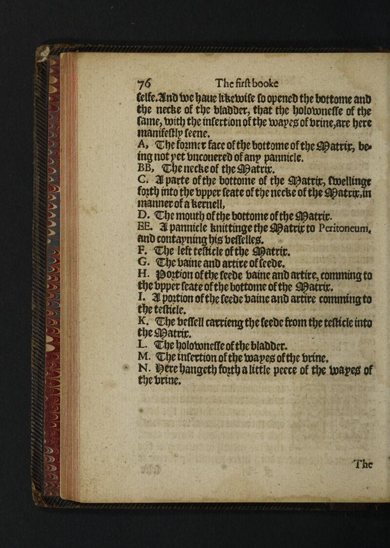 7 6 Thcfirftbooke fclfc.^nH toe bane itfcetotfe fo openeb tbe bottome ant) tbe necfce of tbe blabber, that ttje bolotoneffe of tbe fame, txjittj tbe infection of tbe toapejs of brine,are bet* mantfefilp feene. A, ‘®t)efoimjtfaceoftbebottomeoftbe#atri]r, be* ing not pet bncottereb of anp panniele. BB, cbenecfteof ttje#atnt. G. % parte of tbe bottome of tbe <&9attiic, ttoelltnge fo?tb into tbebppet feate of tbe necfee of tbe ^atctt.m mannetofabemell, D. cbemoutboftlje bottome of tbe i©atti;e. EE. % panniele ftnittinge tbe ^atrijc to Peritoneum, anb contapning bis belfelles. F. Cbe lefttefltcleoftbe S^atrit. G. tlDbe baine anbarttte of feebe. H. ^ojtionoftbefeebe baineant)attire,commingto tbe bpper feate of tbe bottome of ttjc <8£atrir. i* Z portion of tbe feebe baine anb artire comming to tbe tefticle. k. tcbebeffell catriettgtbe feebe from tbe telticle into tbe^atefc. L. Cbe bolotoneffe of tbe blabber. M. 'Cbe tnfettion of tbe toapejs of tbe brine. N. l^cre bangetb fojtb a little peece of tbe toape£ of tbebrtne. The ,, - - .....