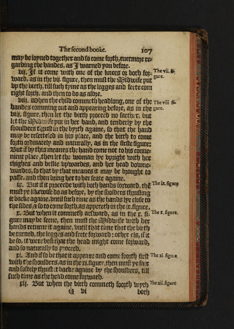 map be iopneb together anb fo come forth,euermort re* garbing the banbeg, as! 31 boameb you before. btj. jf it come boith one of tbe imeeg mbotb fo?i^*Tii §! boarb, ag in the bit figure, then mud the captbboife puts ' bp tbe birth, till fucb tprne ag the legged anb feete com tight fo?tb> anb then to bo ag afo^e. Mb. *©hen the chilb commeth beablong, one of the The vm & hanbeg camming out anb appearing before, ag in the sur«- bin. figure, then let the birth Prtcceb no farther, but let the spbtoife put in her hanb,anb tenberlp bp the Ipoulberg thrift in the bprth againe, CO that the hanb map be refetteleb in hig place, anb the birth to tome forth ojbtnatelp anb natutaUp, ag in the firfte figure: ©ut if bp thig meaneg the hanb come not to big eonue* nientplace,thenietthe bootnatt Ipe bpjtght boith her thigheg anb beltte bpboatbeg, anb her heab bobane* boarbeg, Co that bp that meaneg it map be brought to paffe, anb then bjing her to bet feate againe. tr. ©ut if it pjoceebe boith both hanbg fotboarb, thf The mult pe iibeboife bo ag before, bp the iholbetg Suiting it bathe againe,bntil fitch time ag the hanbg Ipe clofe to tbefibeg,® Co to come forth,ag apperetbtn the ir.ffgure. p. ©ut boben it commeth atfboatb, ag in the jr. ff;Thcl-££ure- guremapbe feene, then muft the ^tbtotfe boith her hanbg retume it againe, bntil that time that the birth be tunteb, the leggeg anb feete fojtboarb: other elg, if it be Co, it boecebed that the heab might come fojboarb, anb fo naturalip to poeeeb, pi. 3finb if fo be that tt appears anb come foorth fiedThe» %-« Sxiith the fi)oulbetg,ag in the ri.figure,then mnfi pe fair anb foftelpthmlt it bacbe againe bp theihonlbetg, till fucb time ag the heab come f^boarb. pij. ©ut bohen the birth commeth foorth bopth1IwxiiJsBre feS hi both