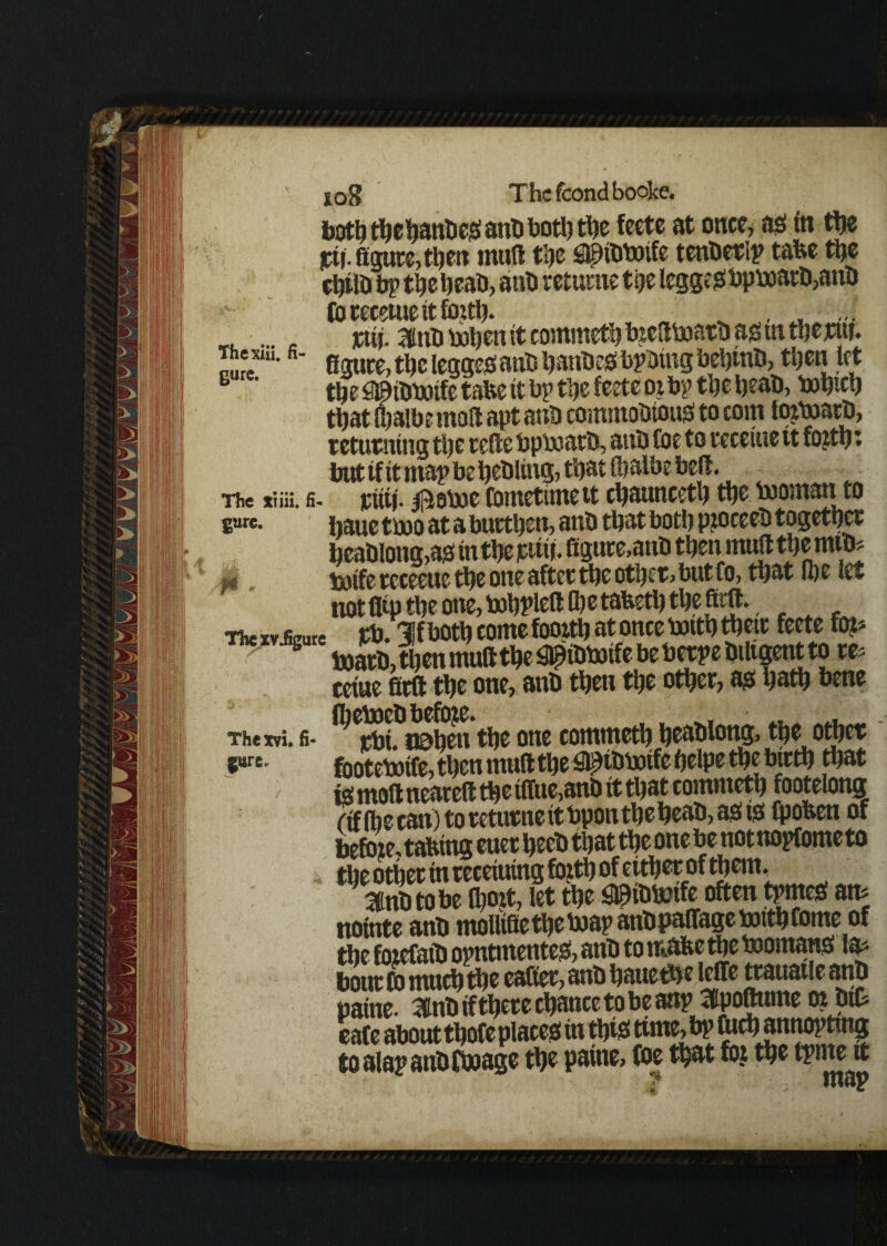 both thehanbcs anb botlj t^e feete at once, ael in tt>e jcti figure, then mull the fispititnlfe tetiberip tabe ttjc thilb bp theheab, anb retume the lcgge$bpb}arb,anb forccetue it forth. ^ . , ... . . pttj. Hnb bohen it commeth bred boarb as tn therut. I '--R' figure,the leggedanb banbeafbpbtngbeijmb, then fit B ‘ the fpbbotfe tafce it bp tlje feetc or bp the heab, bohtch that foalbemod apt anb commobtouS to com fozbjarb, returning the rede bpboatb, anb foe to receiue it fojtf?; but if it mapbe fiebltng, that ffialbe bell. The tun. s. rittf. I^oboe fometune tt chaunceth the tooman to £*>«• fiaue tboo at a burthen, anb that both pzoceeb together beabIong,as in the pttif. figure,anb then mud the mtb? boife rcceeue the one after the other, but fo, that (be fit not flip the one, tohPfid ftc tafieth the firft. Hwxvjiimte rb. 3!f both come fooith at once boith then feete fo?? > 8 toarb, then muft the ^ibboife be berpe btfigent to re? ceiue fird the one, anb then the other, a# hath bene The™, a. ^Sfmhen the one commeth heablong, the other 5«r£- footebotfe, then muft the S^ibbotfe helpe the birth that is moil neared the tffue,anb it that commeth footelong fif (becan) to returne it bpon the heab, as to fpofieti of before, tafcina euer heeb that the onebe notnopfometo the other in receiuing forth of either of them. Sfnbtobe (bort, let the mmfo often tprneS m nointe anb mollifietheboapanbpaffagebJtthfome of the forefaib opntmentes, anb to mafce the boomans la? bout fo much the eafiet, anb hauethe leffe trauatle anb name- 3Cnb if there chance to be anp Sfpodume or btfi cafe about thofe places in this time, bp fuch annoptmg toalapanbfboage the paitte, foe that for the tpme it ? OWP