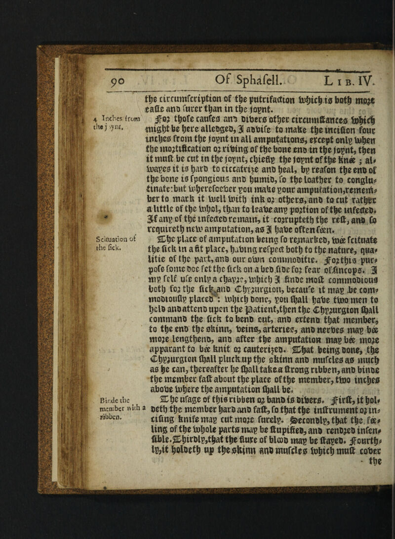 4 Inches hum the j >yn i. > Sck'uation ot the fick. tlje circumfcription of the puirtfaction U>bicb ts both moje eafie ano furertban tit the jopnt. j?c? ttjofc caufes ran tibers otljec ctrcunittantes tobtdj might bo ijerc alleogeo, 3 aobife to make ti>e mcifion four inches from ttje jopnt in all amputations, accept onlp tuben tbe modification oj ribing of ttje bone eno m t^c jopnt, then it mnfi be cut in tbe jopnt, cbieflp tbe jopnt of tbe Knee; al» (napes it is barb tociccntrtje ano heal, bpreafon the eno of tbe bone is fpongious ano bumio, fo tbe loatber to congln* (mate: but toberefeeber pen mahe pour amputation,remeirt* berto math it tnell liutii inhoj others, ano to cut rather a little of tbe tabol, than toieabeanp pojtion of tbe tnfetteD. 3fanp of tbe mfectco remain, it cojruptetb tbe reft, ano Co rcqutretb nelv amputation, as 3 babe often feen. 2Dbe place of amputation being fo re.marheo, toee fatnate tbe fich m a fit place, babmg refpect both to tbe nature, qua* litie of tbe part,am our ohm commoDitie. ^fojtbis pur* pofefomedocfettfiefiction abeo finefoj fear offtneops. 3 nip fclf ufe cnlp a ebapje, mbit!) 3 finoe moft commoDiou3 both foj tlje fich auo Cljvjtu'gion, because it map lie com* mootouflp placeo: mljtdj Done, pon fljall babe ttoo men to bclD ano atteno upon tbe patient,then the Ctjpeurgton (ball commanD tbe fich to beno cut, ano erteno that member, to tbe eno tbe shinn, beins, arteries, ano nerbes map bee moje lengtbeno, ano after tbe amputation map bee moje apparantto bcehnit o? cauterijeo. being Done, tbe Cbpjurgton (ball plucfcup (be shinn ano mufcles as mud) as be can, thereafter be (ball tahe a ftrong rtbben, ano binoe the member faft about the place of the member, ttoo inches abobe inhere the amputation (ball be. X be ufage of this ribbenq;banD is Dibets, jfirft, it bol* member v,'nh a oetb tbe member bare ano fall, fo that the instrument oj in* Hbbco. cifing hnifemap cntmoie furelp. j&econolp,that t|e fee* ling of the tobole parts map be ftnpifieD, ano rcnDjcD infen* flble.2&bttDlp,tbat the flute of blcoo map be ftapeb. Jfourtfj* lp,it boloetb up the shinn ano wuifdes tobicb mutt cobec • the Binde the