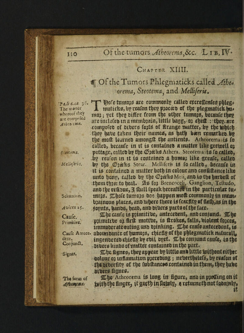 guotema. M differ] 5. If! i '• If'SlJ Scuunuon. Avlcen if. Caufe. . Primitive, Caufs Antccc. dent. Conjunct. Signer* The form of 4thw*& Ikiii ffi Of the Tumors Phlegmaticks called Aibe» r oretna, Steotema, and MelliferU. Tl^ofe tumojs arc commonlp calleD ercreffenfes pbleg* matiefes, bp tcafon thee pjoceeD of the plegmaticfcba* mo?; ect thee Differ from ttjc other fumojs, becaufe thee ate tr.clofea tn amembjain, little bang, o? cbeft : tbee.are compofeo of others foils of ft range matter, bp tlje tobicb tile? babe taken their names, as bath been rematkeo fig tijc mod learneo aroongd the antients. Atheoremi is fo ealleo, becaufe in tt is container a matter likegretoello; pottage, calleD be tt)e (JJjSEkS Athera. Steotema -.is fo calleD, be reafon in tt is contdneo a b«»«e? like greafe, ealleo be ttje Cheeks Stcar. Melliieris ts fo called, becaufe in ■it is containsD a matter both tn colour ano confiftance like unto bone, calico be tbe ©jeeko Mdi, anDistbebatDed of tbeintbJK to beal. #S for Brencnceli, Ganglion, Teftudo, ano tbe refioue, 3 fball fpeakbereaftefin tbe particular tu< mojs. jEljoie tumojs Do? happen mod commonlp tn menu* bjainous places, ano inhere there is feaefite of flelb,as in the , joents, bands, beao, ano others parts of the face. %\ys, esute is pjimitibe, antecedent,. ano conjunct, pjtmitihe oj firtt motibe, is drokes, falls, biolent fojees, immoderate eattng ano drinking. catife antecedent, is abotmdance of humors, tbiefle of the pblegmatick naturall# ingenoereb cbiede be ebil sect. %\>s conjunct caufe, is tbs dibets kinos of matter contatneD in the part. 2Dbe fignes, thee appear be little: an# little toitbouf either Dolour 0} tnfiamation pjeceotng; nebertbelefs, bp reafon of Ibtbtbcrfite of the fubftancss contained in tb8ro, tb«B babe others fignes. %\t, Atheorema is long in figure, ano in plotting on it frith tlie finger, it gsttb in flotole? t rcturnetb not fofiainle, ‘.' '~i ■'. 'it