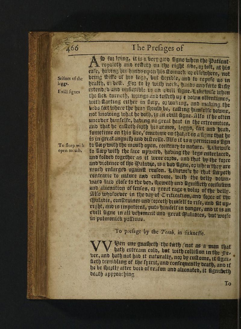 JL Stifncs of the ieggs. Evil] iigncs To fkep wi h open mcuih, I he Prefages of p fsj lying, itisabcrsgroo ggne totjsn fbe ©afient* ! -rtpoieil) anc reteib right file, pj left, at big cafe, bat;t‘u yt<: banasnpoh bis Goiimck or elfetohere not being ttiffe of gft« legs*, but Qcpible, ana to repofe as in t)ca111?, is be#. jfoj to ly tuifb neck, banas ana foete ttiflp erfenOea ana tmfiepible is an etuil figne.lUkctotretoben tljefiefe turnetb, tarings ano tottctb up t aoto* oftentimes iuitb darting cither in ficep, or‘limiting, ana roakintt the bees feettoljere the beats fkoula be, catting bimfelfe ootune not knotting ttljat be both, is an etnll figne.aifo if be often wncober bimfelfc, babmg no great beat in the ertremities ana that be cattetb forth Cannes, leggg, f®t anI) h£all’ fometime on tbisfiae/ometime on tbat,itis a Gone that be ts in great angutlb ano Dttteetic.atfo it is a pernicious Can to fieepttitb tbe montb open, contrary to nature. ILikettife to noeptoitb tbe face upttara, baling tbe legs enterlacea, ana folaca together as it toere cores, ana that bp the foice ana biolencc of tbe ajsalaaie, ts a bao ttgne, or toben then are mucb enlargeo again# ceafon. ILikettife he that Mneth contrarte to nature ano cuftome, iiutb tbe bells ooton> Inara lata close to tbe bea, ibe ttctlj ano figntfietb confufion ■SS a4ll,eati°n offe«fe3> « great rage taolor of tbe belly. SUfo tobofoeber in tbeoay of Caticatton,ana fate of tL fipalaBie, conttratnes ana fojcetijbitttfelfto rtfe, ana fit un. right, ana ts impatient, puts bimfelf in oanger, ana it is an eaill figne tn all beb*ment ana great Spalaotcs, but tooife in pulmontck pafftetts, ~ ro*lc •. '* ;'' ' '' # » . , < s , ’ - ^ T,r I; v ■ * .r rf ,1 JC. To prefage by the Teeth, in ficknefle. W ten one gnafijetb the teeth fnot as a man that W* ‘fIream £Dl0’ bBt tollifion tn the ie> Dec, ano tjattj not i)ao it naturally 1103 tig cufltomo*, it fiart* 4 Setl) trembling of tlje fjJtrtt, ano contequenflp ceatb ano if oeatb approaching a 9 - — ' - .■ To
