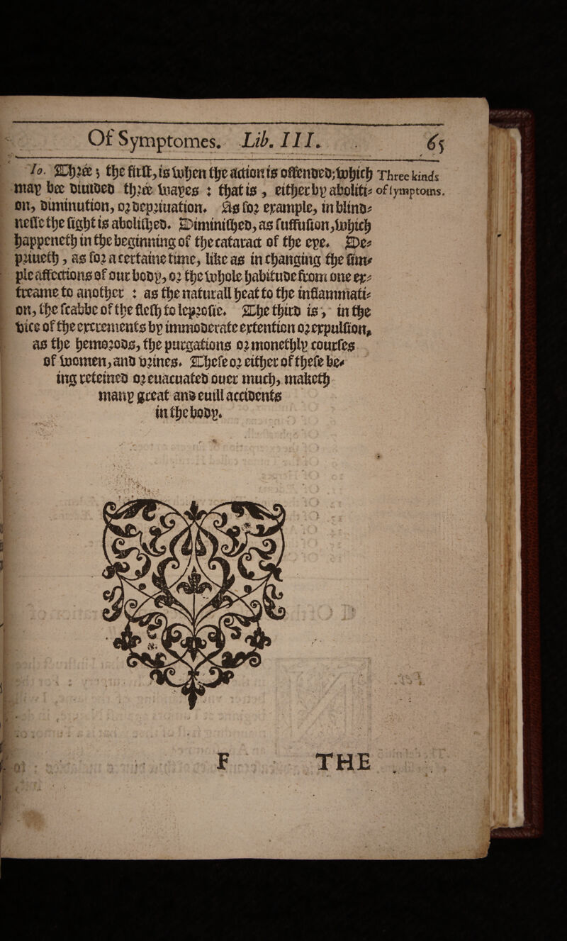                  Ot Symptomes. Lid, I re ee 65 may bee dintded thre apes + thatis , eitherby abolitiz of tymptoms. On, Duminution, ozdepiuation. Ag fo2 erample, inblina- neflcthe fightts aboliized. Diminithen, as (uffukon inbich Happeneth nthe beainnine of thecatarad of the epe. Dez puueth , as fo2 acerfatne time, like as inchanaing the fine pic affections of our bony, o2 the iuhole habitude from one ex- firame fo another : as the naturall heat fo the mfammiatt- on, the icabbe of the fleth folepeofic. She third is, inthe bite of fhe eycrenients by mmmoderate ertention o2erpulfion, as the bemo2ods, the purgafions o2monethly courfes of {uomen, and vines. Wheleo2 either of thele bee ing reteined o2euacuated ouce much, maketh maiiy geeat anv cuill accidents inthe body.