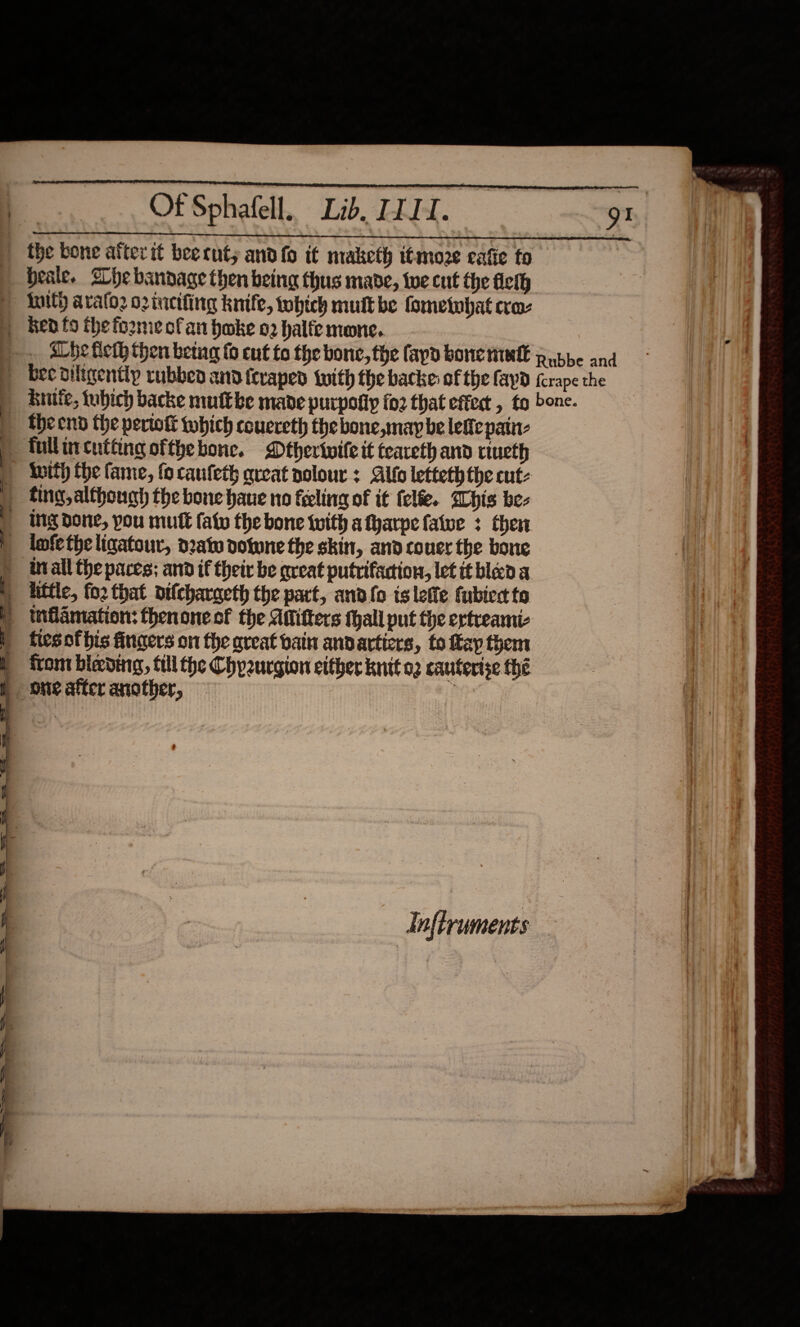                     Of Sphafell. Lib, ITIL. the bone alter it bee cut; and fo it maketh itmoze eafie to beale. Zhe bandage then being thus made, te cut the fielh ) inith aralo2 o2incifing knife, tobich mult be fometwbat cro ) ken to the fo2me ofan hoke o2 halfe mone. . abe fleth then beg fo ent fo the bone, the fayd bone niet Rubbe and &gt; becdiltgently rubbed and tevaped twith the backe of the fayd (crape the Enite, tubich backe mutt be made purpolly fo2 that effet , to bone. the end the pertoft which couereth the bone,may be lefte pain: | fullincutting ofthe bone. Dtherinife it teareth and tiueth inith the fame, fo caufeth great polour + Alto letteth the cut: ) ting, although the bone hane no feeling of it felfe. SChis be- | Ing done, pou mutt fatv the bone with afharpe fatve + then | lnfetheligatour, o2atw done the skin, and coucr the bone ) tall the paces; and if their be great putrifaction, let it bled a | little, fo2 that difcharaeth the part, and fo islette fubiedt to wmfiamation: thenoneof the Atitters thall put the ertreami- | ttesofbis fingers on the aveat bain andarticrs, fo fap them | from bieding, till the Chpzurgion either knit a2 cauterise fhe ore after another, i  Inftruments 