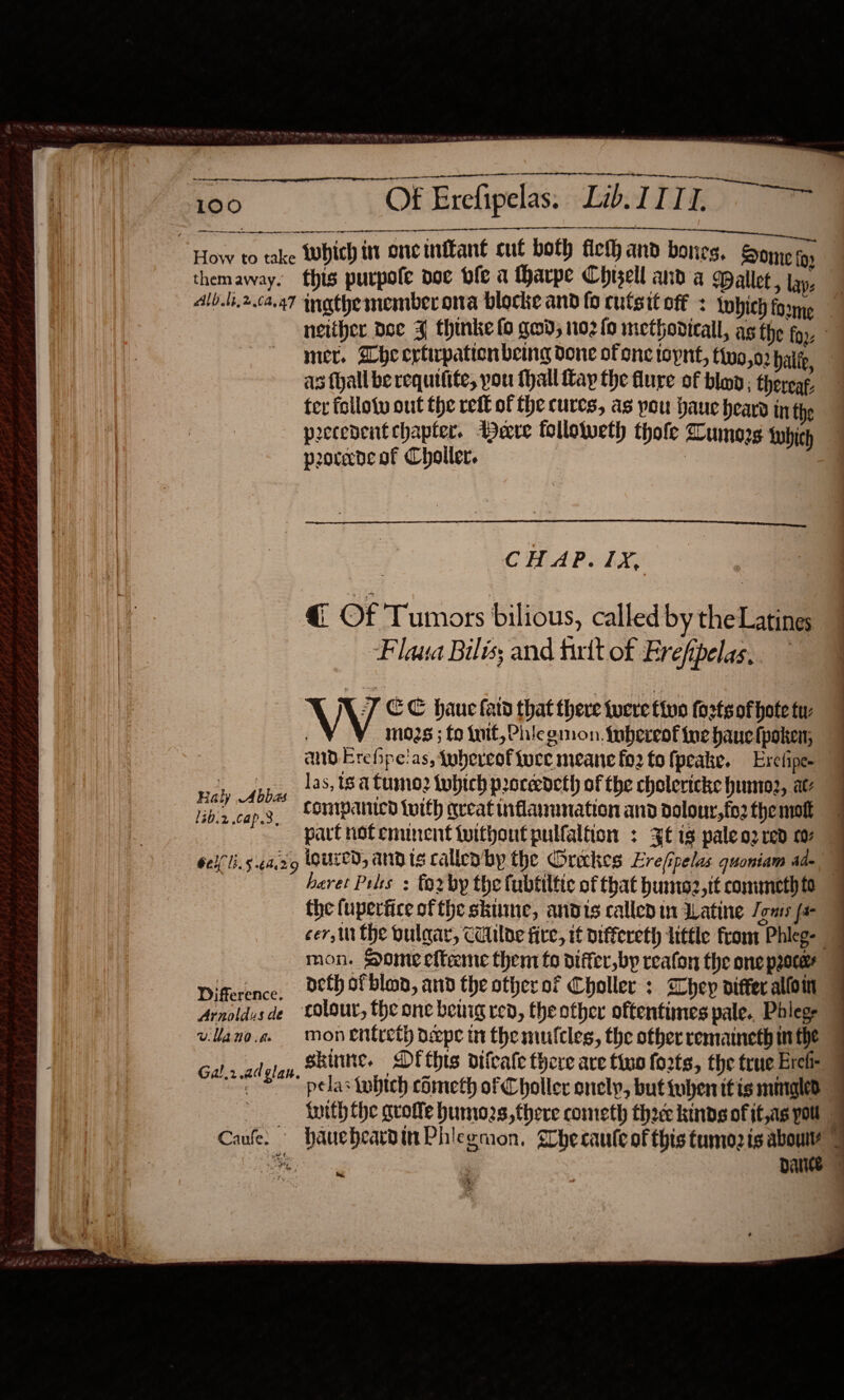                       ed 100  Pe RF eee toy al OF Erefipelas: Lb: TTR 9 RMT Ree ee ie a cm be Ds ily intl gr How to take Which in oneinffant cut both fich and bones, Some fo themaway. this purpofe doc ble a Harpe Chisel and a Mallet , lay. Alb.li.2.ca.47 inathe member ona blocke and fo cutsit off : Lwhich foxme neither doe Z thinke (0 ged, 1102 {0 methovicall, as the fox: mer. Dheertipatien being done of one topnt, thvo,o2 haltp, as hall be requifite, you thal fay the flure of blo ; therear. ter follotv out the reff of the cures, as pou haue heard inthe peecedentchapter. Deere followeth thofe Zumorg Which peocade of Choiler. | A at    CHAP. 1X, € Of Tumors bilious, called by the Latines Flava Bilis; and firtt of Erefipelas, V J EC haue fard that there tuere five forts of hote tu: _ M035 ; fo Lit, Phicgmon. Iubereof ine hauelpoken, 7 and Erefhpe'as, whereof ivce meane fo2 to fpeake. Erefipee 7 ny A las, 18a Cum? tobich poceedeth of the cholericke humo, at bz.cap.3, “oMIpAnIcd totth areat inflammation and dolour,fo2 the moll part notenunent tuitboutpulfaltion : 4 is paleo: red c- Ge(Li. 5.44.29 igured, andis callea’by the Oreckes Erefipelas quoniam a= heret Pehs : torby the fubtiltic of that humo2,tt commeth to the (upertice ofthe skine, andis called in Watine Jgnts fa cer, the oulaar, Ciulde fire, if piffereth little from Phleg- © mon. Pome efteeme them to differ,by reaton the one pocer Difference, O&amp;tb ofblan, and the otherof Choller : Whey viffer allo Arnoldusde ‘Colour, the one beuig red, the other oftentimes pale. Phleg- vllano.e. monentreth dpe in the mulcles, the other remaineth in the skinne, Df this difcale there are tino forts, the true Erel- pelas iubtch cometh of Choller onely, but tuben itis miigled tuith the qroffe humozs, there cometh thoce kinds of it,ag pou | Caufe. haueheardinPhleemon. Shecaule of this tumozis about 7 oe : Darice 7 Gal.r.ad glan. 
