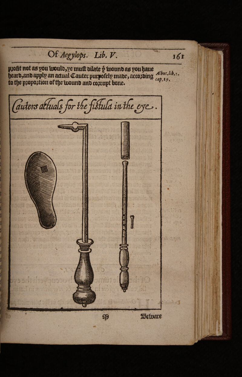 profit not as you twould,ye mutt dilate p wound as pou haue beard,and apply ant actual Cauter purpofely mane, according fo fhe propoztion of fhe wound and cogrupt bone. Albuc Uib,:. cap.t9. | i 4 Li - - =~ a ~~ a * = | fe = = . « } ane. | * a Hit E (eA) = - rem se tetany q ‘ Maes |b de 