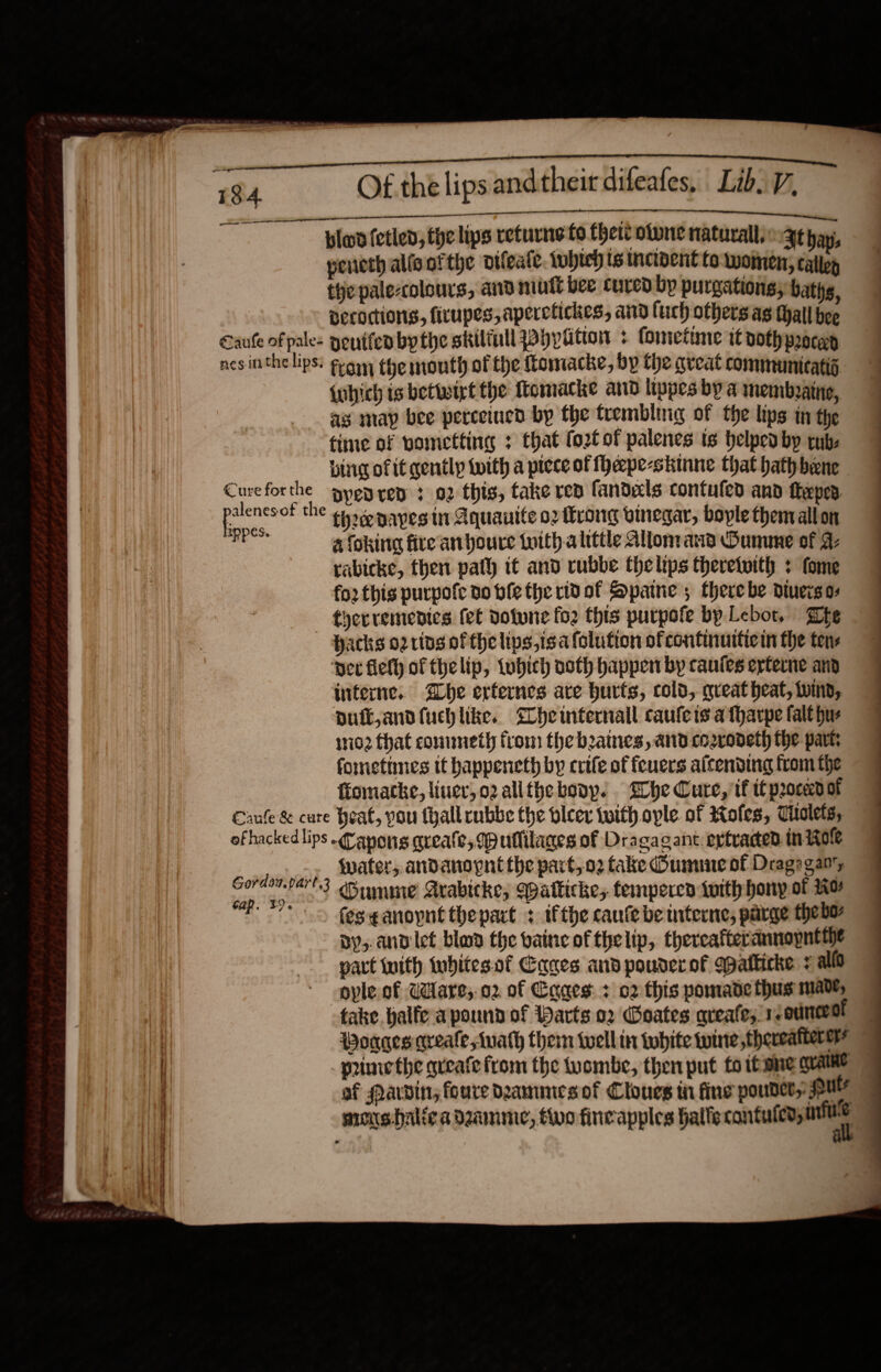                                      Of the lips andtheir difeafes, Lib. V,  18:4. ama blood (etled, the lips returns fo Chet otune naturally gt bays peneth alis of the difeate. twhteh ts incident to: women, Callen the pale-ccolours, and mutt bee cured bp purgations; baths, pecoctions, firupes, aperctiches, and luch others ag thall bee Saute of pales geutfeabythe skiliull pPhptitton + fometime tooth proce nes inthe lips: fai the mouth of the tomacke, by the gveat communicatij {which is betwixt the Momacke and lippes by a membzaine, as map bee perceiued by the trembling of the lips in the time of vametting : that fo2t of palenes ts helped by tub: | ving of it gently with a piece of fheepe-skinne that hath bene | Cureforthe pen ren 3 02 this, take rep fandels contufed and teper ao the tp eonapesin Aquanite o2 frong vinegar, boyle thenvallon om a fokina fireanboure worth alittle Allon: aid Ounune of 9 rabicke, then path it and rubbe thelips theretwith : fome fo2 this purpofe do ble the rivof Spaine; therebe dinersos 7 -- therremedies fet votune fo2 this purpofe by Lebot, Be | Hacks o2 ring of thelips,isafolution ofcontinutticin the tens 7 ‘vet flefy of thelip, tubich noth happen by caufes eyterne and interne. be erternes are hurts, cold, queat heat, Winn, Dui, andfuchlike. Che mfternall caufers a tharpe falt hur wie2 that connneth from the baines, and coovodeth the part: fometimes it bappeneth by crife of feuers alcending from the fiomacke, liner, o2allthe body. Ehe Cure, if it poced of Canfe &amp; cure heat, you thallrubbe the leer with ople. of Holes, Tholets, of hacked lips .apons greate, ullilages of Dragag ant ertraced inizore ners water, andanopnt the part, 02 take Ounune of Drago gan, ‘ip ne 4 Oumme Arabicke, Watkickes tempercd tuith hony of 20+ 1} fes¢anopnt thepart + ifthe caufe be interne; parge thebo dy, andlet blon the vbaine of thelip, thercafterannopnttie part ith wubitesof Cages and pouderof qatticke + allo ole of Ware, o2 of Cages: + 02 this pomade thus made, take halfe a pound of Darts o2 Goates aveafe, ssounceol | Woagesareale,Auath them twell in tobite wine thereatkere’ I primethe greafe from the wombe, then put to thse QUaiNe of Mardin, foure dDammecsof Clones wi fins poudlee,. fut moushalica dame, vo fincapples halle cantufed, in