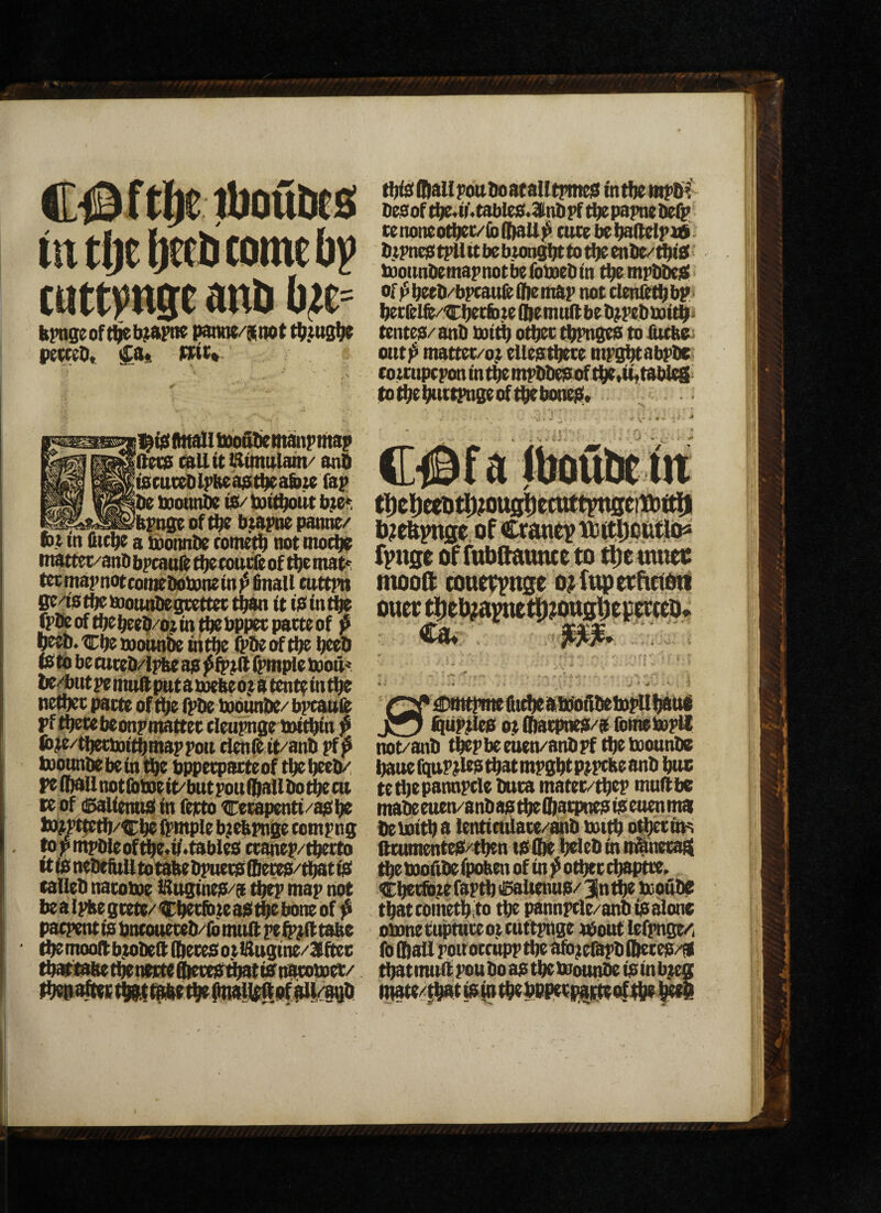 tit tljetietD comet))? cnttpse and krngeof ^i^pne pawe/stiot cbjusbe petc^d, Fcic* jl^iCtSttaU tuofidemanfmap Oras mil it iSttnttlatn/ and (tscttt^lrlteaaitbeafote Cap |de snotmde is/ tuitbout b.te* _?bpnge of tbt djapne panne/ nt in 6t^ a iibonnde rometb not tno^ tnattet/and bpcatiie tbetoude of tbe tnat<: tetmapnoteomedolDnein^finaU cuttpn ge/iatbeinotuidegcettetti^ it iOintbe fptkoftbebeed/ojin^bppetpatteof f b^'Cbtmonndein^ ^deoftbe deed IS to be tuced/lpke as ^mple bjott* de^iut pe nrnft put a boebe o.t a tentt in tbe neibec pacte of tbe Ipde bjbunde/ bpcauie pf tbecebeonpmattet cleupnge tnitbin p wie/ibettoi^mappott tienft it/and pf ^ taioundebein tbe bppecpacteof tbe deed/ peibailnotlbttieit/butpouiballdo^ca ct of dSaliennS in feitto Cetapenti/asbe bDitmtb/Cdcipntple b^ebpnjje tompng topmpdieoftbe.i/.tables tcanep/tdetto ttisnedebmtotabedpuetsflieces/^tis tailed natotoe iSngines/a ^ map not bealpbegcete/'CbttfineaStbtbbneof ^ pacpent is bntoueted/ld mult pe tabe ' ibtmooltbtodea(betesoti^ugine/3(ftec tdattabetdenmeflietes^tisnacobDec/ tbiSlbaUpoudoataUtpmes intbe mpdi' desof tbt<i)'>tables.3indpf tdepapnedelp tenoneotdet/lbilKiU^ cutebedaltelpnsi- dtpnes tpll it bebumgdt to tbe ende/^S > tooundemapnot be foboed in tbe mpddeS ■ of f beed/bpeauit fbe map not clenlttb bP' betlelft/Cdttib te fldemult bedjpedbaitbi tentes/and mi^ otbet tbPngeS to iutbe- outp mattet/o} eliestbtte mpgbtabpde cottuptpon in tbe mpddesof tbe,iit tm^^ to i^e buttpnge of tbe bones* l)?eftpn0e. of Crantp tbtfDofitlb* fpnse of fnbftatmceto ^emnei: mooft cottst^tige o^fnpepttetoti ouep Ca*-, , .. ’ • - t ■ : i- ♦ ' ■ * . * QPtfmtQimtotbcftittoftdeib^bawj j55t iiluWiw otO)stpncs/Sfom»top» not/and tbepbe euen/andpf tbe tbounde dauefqup^stbatmpgbtpfptbeand btu; teaiepannpcle duta matet/tbtP muObe madeeuen/andastbeibatpnesiSeuenmai deioitb a lentictdace/and untb o^uh fttumenteS/tbtn tSibt btled m nilnetaa tbebooAdefpobcnofin^otbeccbaptte^. C^(fb^faptbllSaltenuS/^n^ booude tbatcometbito tbe pannptle/and is alone obonetimtuteottuttpnge tdout iefpnge/i Ibfftallpoiroetupptbeafojcfijpdibetes/S tbatmuapou do as tbt tbounde tsmb}m mate/{bbtisiutbtbppet|f«pteQ|tl^tie^