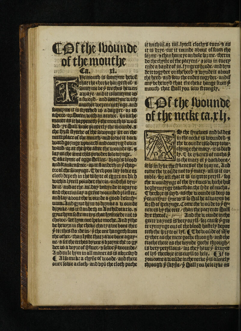 Co* Its* fomtrfne (i^eebei^ant^t^ ii]iRt^^tW]S> teet^ Ijetiietv 8iBb{ie/anti it lefbnttrMi *6- aibxHsti/ andibiRtlmtbDiti^ -8nbti^t»et)encatt|lise.anfi foWmtttteftptt^D abagstt/ot m aibei^o;4taimi»ii$anato)ue;ln(in!i^ <nanec8aitbap|)eM^fti)em()aii{tjS)xio» bbb/pelftaUfoaliemopetlp tbt )jbb(intv.9 oni^ibb^e tet on ti^ nottspitaceof^mon^^fobieit bata luai^SbFnsebpbjatlf^eontiitgboban lDaii)/;ib3^atti)tQ)tiebftja:tt)e)»ountetjS. $ tepQn^feimtbiaimi9i>tie(fi)lob)Fnsb. Cateii’mt of ibagca bioolt anbfcanttmItnce/aaittftantKti) in ]$tt;ap< tceofjibeibinFnge.'Cbecbpon rap tobieo^ (loti) bepeti) in tti^ptc of esses UK bk b lbtl^lpteltpoU)bettbecin/atS>tt)a^n< beit/anbattbe.fifjtapfitibpnbeitasaFno enb^monlapastmttounbebplaSect anbi^ about tbe ttotinbe a fbob be(enQ>^ uuta^bspuebpm tobmitea ttounbe bitpnae/'8s tt fianbetb in antl^ibotatio. a BPHSbf^foftemetpstbatbPiKiiebenotto cbob>e/tet bpiR notfpebe mo(be.^nb pf 1^ tebeb)^ tn tbe d^kr tl)atpatt)e bone tbec pteettji^Sonbein/^t^onebangetbftoin tt)eoti^r/tbanlp&etbatp8bieboneasap« ne/afet tbetetfiesbponeabjApiatbf to sp bee i£ aiupteof Q4uet/alba)e j^tnoimbe/ 3Cnb mle bpm in all manetas is afiuefopb C lUbimbeacbpneofbioobe/anbtbete onecibbeeadotb/anbbpotbeclodi) paebs ittnit})U)‘<o)) iiii.lpteH tlotltpS euenJii as it is btpe/ent it eounbe about of fcoiti tbc (b,tme/ad[)8ni)auepeant)de&>$me/ti)etin bofl)etl)pfieoftl)epaepent/ aibba in euetp enbeabanteofinVfpnsetstuobe/'anbbpn beittospbee onttttfbeeb'finpnbeit about ^beeb/anbfDUitbeenbestospbet/anbif anpbel)e)»pb that tbeebeke bange fiont# nioutb-'tbat Qiallpou ibS) Stonglp. tbs QttebeeS anbbSbes intbeneebe tsboounbeb/si tbe b!ounbeisibbeepto)n>i cbPnsetbetna^/itisbeeb ip.t beipkenesof nueba istbetnatpof )>ba(kbone/, itiSmlpfeetbeiPbeneSoftbeb^arne.ainb eometbetpo&benotto^matp/allisitea* (sble/fb^alltbatit is ingtetepetpU/fop tbeiKounl^ngeoftbefpneinesbtbitbtbtS begbpnnpnge taketb on ^e fpbe of nueba ^ Cbew;eisf3Pb/astbe bsounbeisbeep to f mteefpue fpnebies lb dial be albaapes be fii)ilIiofQ)ekpnge.<i!:ometbeb0Oubeto]$^ neives bp tbe eete / than tbe paepente Qali breibebft^^^ Bnbtbeixounbeintbe gtetebapnes iSbetpeupU/fot eaufe i^gte tetpnnpngeoutof tbebloob baitelpbepae tetbtbeipppteoflpf/C^bebQoubeof:^ tp bbec as tbe mete gotbe tb tou gb/anb tbe tcotbetbeteastbeiupnbe ^be %ou^ iSbetppetpUeus/fo^tbepbanep fetnpee of lpf/tbetfo.teitiseupUtobele. CHif to poueomeamoubeintbenecbe^isaionelp tbpottsb ^fliPOe/j^ (H^poubeleipke as