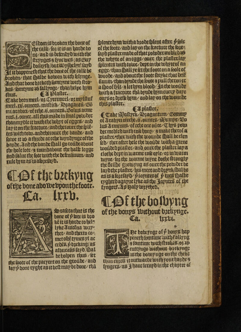 (EUsomtStoolien tljeboneof 't^calfe/fojitiSan ^tlicljo n«/ani) taDe&nDi’Dtuitljti^ ftrpagcs(9tft’netoc0 (aisdeup itofai'tt);butt©plW»?»Ua?fi If ft iwproeft tlwt tt)e to»e of tfte caffe be btobcn/ fljafbe botoen toftb felynge. anbtbatbonebftfectblbmtrimbaitf) ftco bea/fbmtpmeMSfailpnge/tbanljeipe brni thus. Cafeebeenmcel/ojCfWtmecl/ojunplftiif meel.iai.oimccs5.niaftftb/3Bjtagantu/(B6 int atabfti/of ecbe.i).oiinces.58olua: acme nus:4.ounce.3ll this mat® intolpta»tfec ftjanmpDlefttoittbtbetofiPt ofeggeg/anb lapftontbeftactute/attbtbetouettbefplC'' tcs tottb tobB.anlitlfetotiee tbe banbe/ anb fowc fta$ atbtebcatecbctopnbpngeoftbe banbe.SUnbtfiebantefljall gotottbeabottt ti^bolefote/ft tounbabout tbcbalfe Icgge anb falite tbe foteboitb tbe befenffuum/anb tttlc bfm asfisafcftfepb. oftl)eDoneai}otbe))pontl)efoote< Ca. iFFf). ^cafetatbafftitbe bone of tote tab^o befttsbacbetofjef? Ipfeeluftena botpr tbet'' anbtbetto co--, metoftetpmeapiac tebes.]5btebmg(as( albuca((Ofat>b)(tial befcolpen tbus /fet lljefbotcof tlfepacpenton tbc gtoiibe/anb lap bone tpgbt as ft beft map bebone/ tlja ffilentei^pm baftbab^obeliilent afftc #ilble oftbefbote/anbfapontbefeatftttetlfeib^s fapbpfaftetmabeof^tpolcpbetnteUebtO ^tofjpteof anegge/onec fte plalteclap. fplenteSbmtbtotoe/beptmtbetobpteof an egge/than (baft pe fet ^.loote on a foote of f»oobe/anb aboutftfe foote fttpbe that befe ffuum/tbaitbpnbet^fetfeeapuUtbetouec a 8)0 of 6>lt/s Irt bPm bfoob^js tbe bwftbg JjjttbaftattttW ^bpn^f)pme«etj? bape onpsotb^effeffpm/anbtapon tbeiawwbe thisplaftet* CaplaOet; ; ^ Ctrabe ^(ipcb/Bjagantum/ Cpmmp o{3itabpctofctbe.u.buntcS/S^mpe/.ffio lus 2frmeniiS/of etfje one oiice/'CbPS Poto betmeblebixiftbtofelfonp/ amabetbeeof as plaftet'‘ti)ec)xiitbft)ebeounbe fbaUbeclen feb/ ^cafeetbelet^b^oube beitlfa gtene luoubebplaftec/anb^ouettffe plafeetiapa clotbebept tn beatme tofe ople/o; in toatm iupne/fii^tbe tuatmebopne botfielltOHglp tbefledbe gtobopi^ asouettbepobobetbe lapb tfie pia(tet/l)ta meetanb bjpnb (bal be as is afoftfapb/ ^ iopntesof f (I)^b( tpgf)tebagapnetpbeasft)eiQrat$^ of ^ fpngets.3ts!^alpb9jptl)ebv ; C^ftljebofbpg of tl)e bonr^i tbttDoitt t);ebpnge» Cau i^e bofxspnge of p bonpS bap |penetl)fbmtimei»itl)fallpng I afointimetpitb fttobes-ojaft cuttpngettiitljottt bjebpnge astbe bobopnge ontbe cbebc than tnftft it outboatbe toift pout banbe ^ fpngets/aS jbaueletnpbintbe tbaptte of