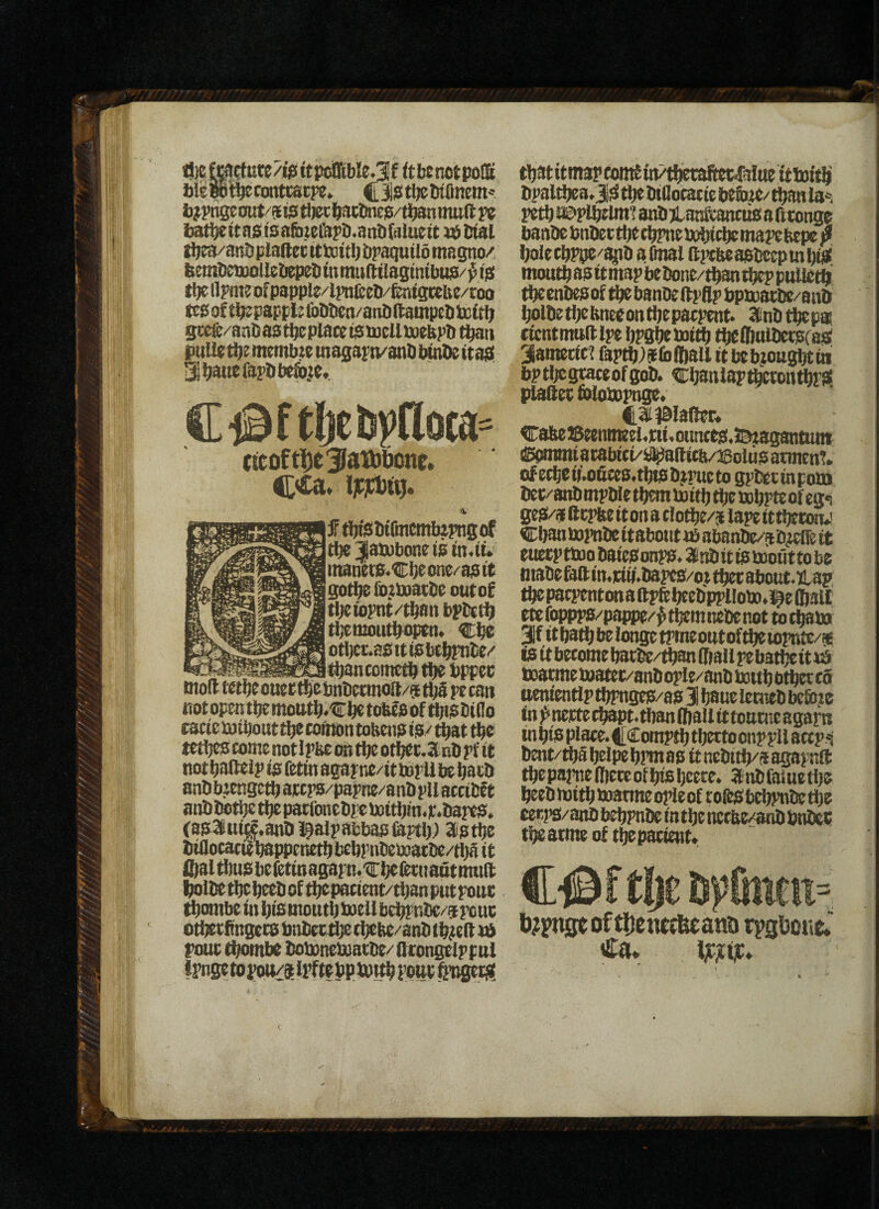 4)cCc$t^ut(/i0tti)ciQtble.3!f (tbtnotpoQii bierot^conttstpe* CistbetrfOnem' l)?pngeinit/9tstljCTbactine0/tlwnimift?? batbetta0tsafo.terai’i).ant)(iilue(t v(> Dial tb^/antiplaRet ittnitlj bpaqutlo mspo/. bentl)eu)olleliep?titnmulltlasmtbu0/^t0 tt)c UPtiK of papple/lpnfeeb/fenfsteue/roo of tbzpappl; (bblKn/anbilaDtpeb tcf tt; gcefe/aabas tbc place t$ti)cUU);bpl) t^ti puUe^e membic magapn/anb btnbe itapt Hbattefapti before. (teoft|}e3latbl)onr. %■ ftbbsbtlinmtlamsof tbejatvbonctam.tu inaners.Cb^one/a0tt gotbe fo.:i»atl)e outof tbciopnt/tban bpbttf) tj^mouti^optn. Cbe otljcr-asittebt^be/ tbancometbtbebifec 9nl)ccmoft/3tl;arecan notopentbemotttb.trbet(«iedoftbi0bt(lo tacie loibout tl^ comon tokenp 10/ ^at tbe tctt)C0 come notlpbe oit tbe otbec.anb pf it notba(leipi0(ttmagapne/it)n!'Ubebacl> anb biengetb awpa/papne/anb pll accibft 8nbbctl)etljcpatfonebittottt>m.>;.bare0. Ca03liiui^.anl>l?alp8i:ba0feytl); aptije biaocactebatvcnetbbebrnbematbe/tbS it fl)altbu0befetinagapn.'Cbe(tt(taiitimtlt fjoltte tt}c beet) of ^ pacient/tban put pout tbombeinbiatnoutbioeUb^ntie/atpcuc otbctfingec0 bnbee^ tbebe/anb tb^ell td pout tbombc bobonematbe/ (Iconselpput tpnsetopou/stlpfltbpivttbpont&tisetft^ tbatitmapcomfin^betafw^alutitto^ bpaltbea.5iiS^toBocaciebe6ie/tbanla*, petb i&plbclmi aubTlanfeanctiaa btonge banbe bnbectbccbpnetDbicbemapebepe ^ bole cbPjjcf ^b a final iiptfte aabccp m iM. moutb 80 it map bebone/tban tbep pulietb tbcenbeaof tbebanbeftpflp bpaatbe/anb bolbetbebneeontbepacpent. SCnbtbepas cicnttmiftlpe bPSbetoitb tbcffialbetpfaal aametici faptb^slblftallitbebjottgbtiji bptijegtaceofgob. CbsnlapftcronfbPS plaftet folotopnge. t3i^#lanet; C8tte2Seemneei.icii.otmce0.2^taganmnt (!5|Hnmiac8biti/ij^gicfi/26olu0 atmenT. of ecbeif.ouces.tbi0b,tputto gpt^tinpom bec/8nbmpbIetbemUJitbbben)bPtcofeg<j ge0/aftepfteiton8tIotbe/5 lapeittbetoiu’ Cbantopnbeitaboutifiabanbe/ab^telieit euecpnt>obaie0onp0. Slnbitianiouttobe mabe an in,tiif.b8pc0/ot tbet about. tLap, tbe pacpentwiaftpfijbcebpplloto.^eftalt etefwpft'pappe/'^tbcmncbcnot totbato 31f itba^belongetpmeoutof^iopttte/se f0 it become bacbe/^iftallpebatbeitiS toatmematee/anbople/anbbJttbbt^co nenientlp tbpngc0/803bane lenieb beibie fn)c>ne]Ctecbapt.tbanfl)aIlittottrite8gafn iubi0Place.CComptbtbettoonpptl8ccp^ bent/lbS btlpe bPm 80 it nebitb/s agapnft tbe papne (ftete of bi0 beete. a nb fai ue 11)5 beebmitbboarmeopleof toft0bebpnbctb5 £etp0/anb bebpnbe in tbe nccbe^wib bnbec tbeatme of tbcpacient» C^f t!je b|>(men= b?Fngtoftl)cn(f6eana Ca. ijcjiiic*