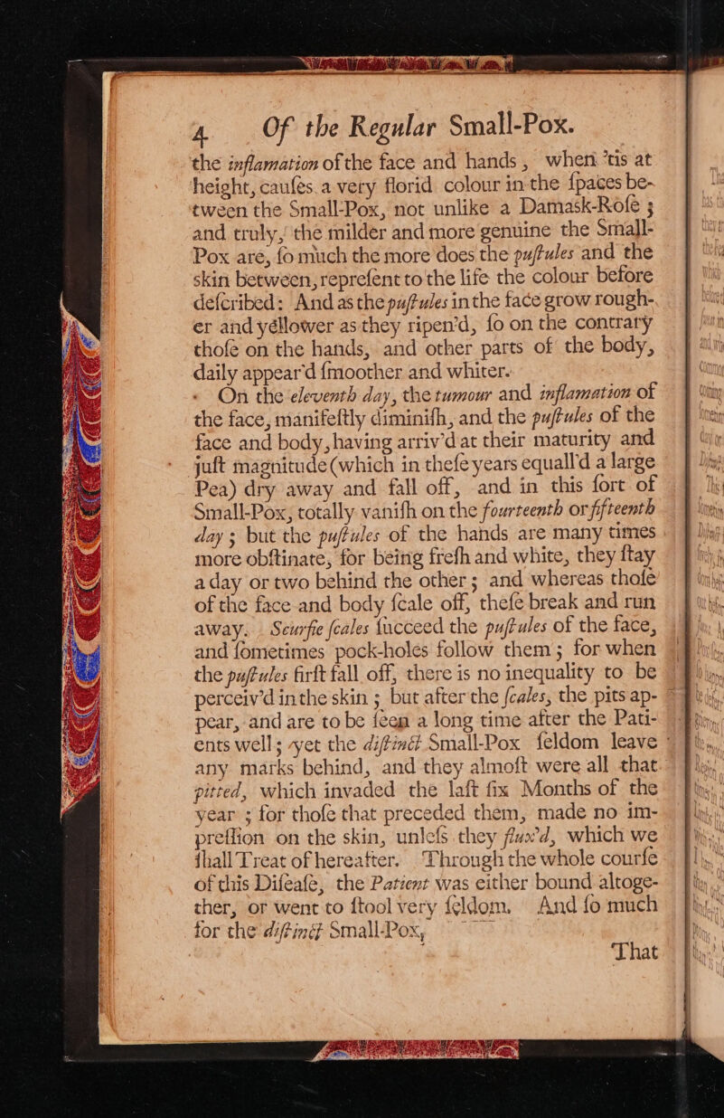 the inflamation of the face and hands , when ‘ts at height, caules.a very florid colour in the {paces be- tween the Small-Pox, not unlike a Damask-Rofe ; and truly, the milder and more genuine the Small- Pox are, fo much the more does the pujfules and the skin between, reprefent to the life the colour before defcribed: And as the pu/Pules inthe face grow rough- er and yéllower as they ripen’d, fo on the contrary thofé on the hands, and other parts of the body, daily appear'd {moother and whiter. On the ‘eleventh day, the tumour and inflamation of the face, manifeftly diminifh, and the pujtules of the face and body, having arriv’d at their maturity and juft magnitude (which in thefe years equall'd a large Pea) dry away and fall off, and in this fort of Small-Pox, totally vanith on the fourteenth or fifteenth day ; but the puffules of the hands are many times more obftinate, for being frefh and white, they ftay a day or two behind the other ; and whereas thote of the face and body fcale off, thefe break and run away, Seurfie (cales {ucceed the pujfules of the face, and fometimes pock-holes follow them; for when the pujfules firft fall off, there is no inequality to be perceiv’d inthe skin ; but after the fcales, the pits ap- pear, and are to be {een a long time after the Pati- ents well; yet the difimét Small-Pox feldom leave © any marks behind, and they almoft were all that. pitted, which invaded the laft fix Months of the year ; for thofe that preceded them, made no im- preffion on the skin, unlefs they fvo’d, which we {hall Treat of hereafter. ‘Through the whole courfe of this Difeafé, the Patzent was either bound altoge- cher, or went to ftool very {eldom. And fo much for the difting? Small-Pox, == That