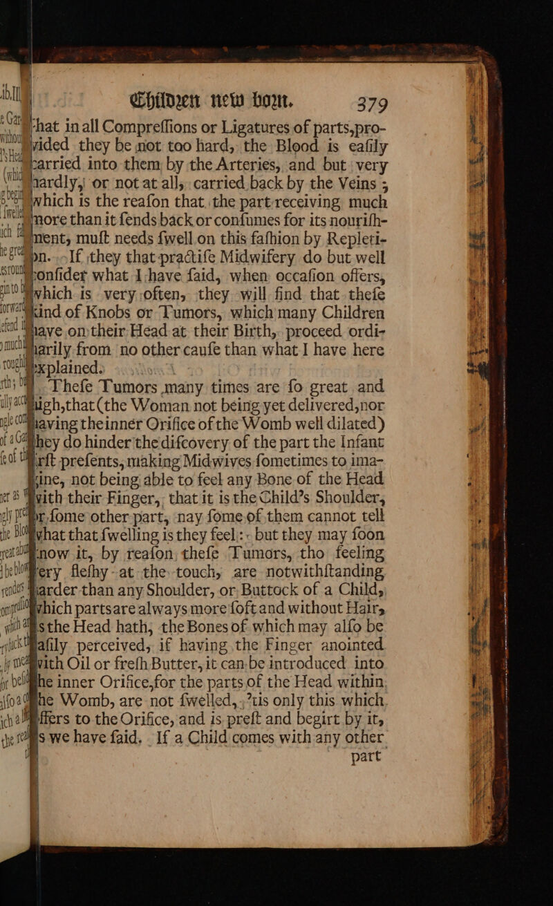*% il | Children new bon. 379 x rhat in all Compreffions or Ligatures of parts,pro- le pidec they be mot too hard, the Blood is eafily ' i arried into them by the Arteries, and but very | ~ ardly,| or not at all, carried back by the Veins ; ®t which is the reafon that. the part-receiving much he more than it fends back or confumes for its nourifh- wt ment, muft needs fivell. on this fafhion by Repleti- teMbn..If they that practife Midwifery do but well sillonfider what I-have faid, when occafion offers, I Uvhich is very often, they will find that. thefe Kind of Knobs or Tumors, which many Children ct Shave on their Head at their Birth, proceed ordi- jmuiarily from no other caufe than what I have here xplained. Lows Thefe Tumors many times are fo great and fugh,that (the Woman not being yet delivered,nor having theinner Orifice of the Womb well dilated) if 0 hey do hinder'the difcovery of the part the Infant rit prefents, making Midwives fometimes to ima- Line, not being; able to feel any Bone of the Head lvith their Finger, that it isthe Child’s Shoulder, ir fome other part, nay fome.of,them cannot tell vhat that {welling is they feel.:- but they may foon now it, by reafon, thefe Tumors, tho feeling lery flefhy-at the touch, are notwith{tanding larder than any Shoulder, or, Buttock of a Child, which partsare always more {oft and without Hairs sthe Head hath; the Bones of which may alfo be Bafily perceived, if having the Finger anointed with Oil or frefh Butter, it can-be introduced into oc beliff#he inner Orifice,for the parts of the Head within. jo ae Womb, are not fwelled, ;7tis only this which. hrs to the Orifice, and is preft and begirt by it, che ms we have faid, _ If a Child comes with any other D | part ae — CE, Map tré a yin aro 3 onde