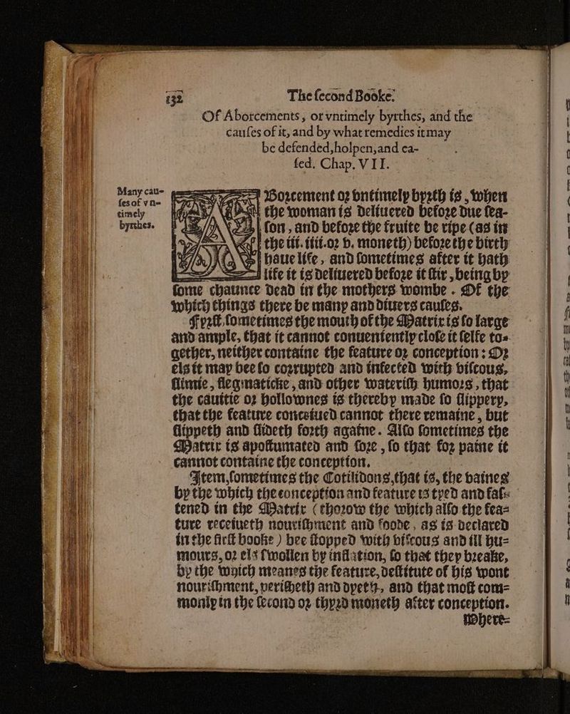 Ha} Of Aborcements, or vntimely byrthes, and the mi Vai caufes of it, and by what remedies itmay | t ia be defended, holpen,and ca- iz Ae fed. Chap, VII. 1 i Saas Borcement o2 bnétnelp byzth is , wher | . 4 ASU the woman ts Deliuered before Due Wa sj Wey fon, and before the fruite be ripe (as itt = f Py the tt. ttit.o2 b. moneth)beforethebithy =|, ‘| ; XS) baute life, andfometimes after it bath i aad life it is DeliueredD before itty beingbp =|, : fome chaunee Dead inthe mothers wombe. DOE the | , which chings there be many and divers caufes. ls iT Fr2t tomecimes the mouth of the Watricts fo large 1 i ml ano-anple, Chat it cannot conuentently clofe tt felfe to i , ae gether, neither containe the feature oz conception : Dz ’ Vie elsitt may beelo cozrupted and infected with bifcous, m . | flintic, flegmaticke, and other waterith humors, that ’ led the cauttie 02 pollovones ts thereby made fo flippery, I eee | that the feature conceiucd cannot there remaine, but Ht E ae flippeth and fideth forth agatne. Aifo fometimes the | iG Watrie ts apokuntated and foze , fo that foz patie te | Bd canitot contatne the conception, Ftem fometines the Cotilidons, that ts, the baines , by the which theconceptionandfeatureistyedandfafe =f ened tn the DBatrir (tho2ow the which alfo the fea= , ture receiueth nouvithment and fnode , as {3 declaredD : tit she firft booke ) bee fopped with bifcous and tl bu= | Mey mours, 02 cls Twollen by inflation, fo that they breake, ail Hy the wyich meanes the feature, deltitute of bis wont = « f ne nourithment, perihech and dypets., and that mot com=- i | monly in the fecon 02 Chpzdmeoneth after conception. ! | ey i | Hebere-