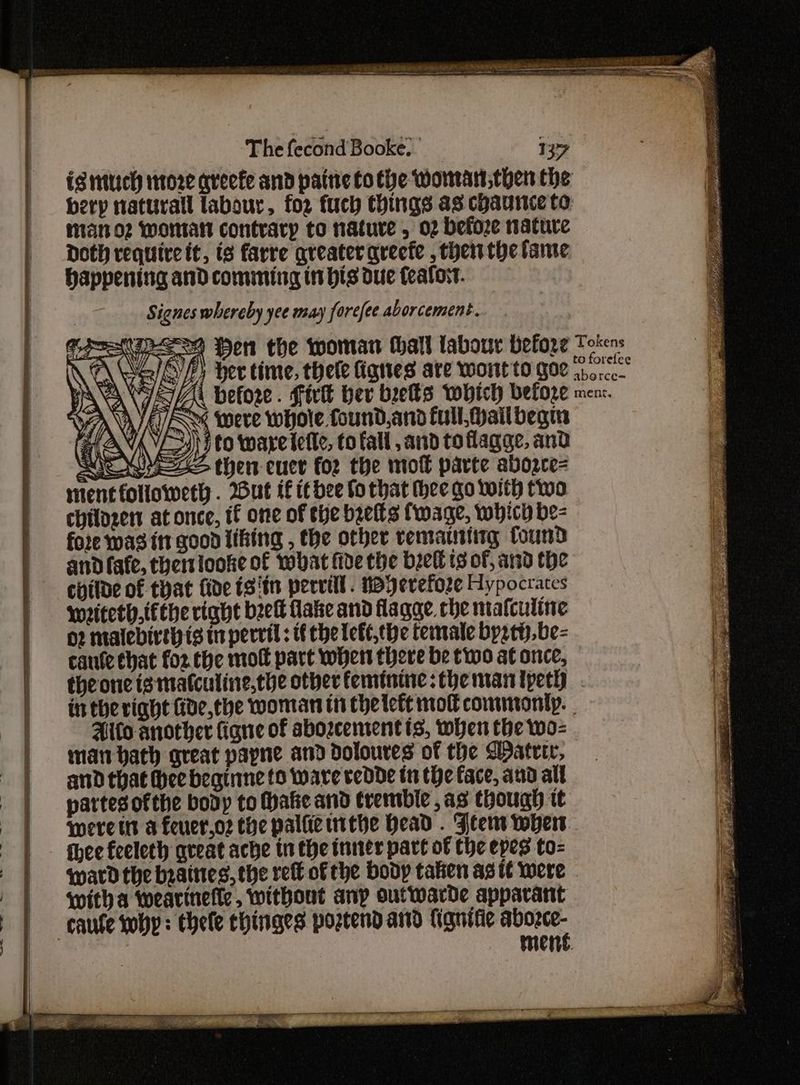 iS mttach tore arecte and pattie tothe Womawt,then the herp taturall labour, for fuch things as cpaunce to mat o2 Woman contrary to nature , 02 befoze nature Doth require it, is farre greater qreefe , then the fame happening and comming it his due feafort. Signes whereby yee may forcfee aborcement. TAT SAU YEAS were whole found, and full, Wail begin ) SS to ware ietle, to fall and to flagge, and ash then cucr for the mow parte abozce= mentfollowetl . But if it bee fo that thee go with two chilozen at once, if one of the beets Cwage, which be- fore was it good liking , the other vematnting found and fafe, ther tooke of what fide the beet ts of, and the childe of tyat fide ts'tn pervill. Keyevefoze Hypocrates weiteth,tfthe right beek flake and flagge che mafculine 02 malebireh ts tn perrtl : tf the lekl,the temale byztty.be- caule that for. the moft part when there be two at once, theone igmatculine,the other feminine: theman tpeth . inthe right fide,the woman in chelett mov contmonty. Aifo another ligne of sbozcement ts, when the wo- man bath great papne and dDoloures of the Water, and that hee beginne to ware vedDde tn the face, aud all partesofthe body to Make and trembie , as though tt were tts a feuer,o2 the palfie utthe Head . Jeens wher thee feeleth great ache in the inner part of Che epes to- wavd the bzaines, the reft of the body taken as it were witha wearinefle, without anp outwarde apparant mene.