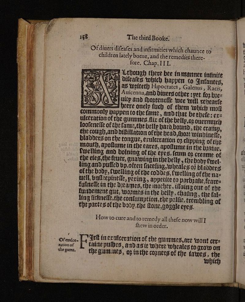 ~ Of diners difeates and infirmities which chaunce to children lately borne, and the remedies th ere- fore, Chap. IT I. near, Cthough there bee inmanner infinite he y | bifeates which bappen to Infantes, aS Yetteth Hipocrates , Galenus » Racis, PA Na7a WY § Auicenna,and Divers other pet for bre= 37 )KQ vy uitp and Moztencile wee will venearte aI bere onely fuch of then Which mokk commonly papper to the fame, andthat be thele:cr= ulcevatton of the guntnes, flix of Cie belip.oz ouermuch foofenelie of the fame, the belly bara bound » the cramp, the cough, and difillation ofthe Head, hort windinerke, bladders on the tongue, erulecration 02 clipping of tye mouth, apotume in the eaves, apottume in the viatie, fwelling and bolning of the eves, feum 02 creame of the etes,the feuer, quawing inthe belly , Che body fwel- littg and puffed op.often fuceling,wheates 02 blaaders of the body, Cwellting of tye Cod028, (welling of fhe naz tell, buflzepinelle, poring, appetite to parbrake.feare- fulnefle tn the Dicames, the mother, tiluting out of the Fuidement gut, woemes in the belly, chatting, the fat- ling ficknelle, the contumption,the palfie, trembling of the pavies ofthe body, tie Toie,gogate epes. How to cureandtoremed y all thefe now will] fhew in order. ration of the gums, catite putes, andas it wyere wheales to grow on Che Curbines, og inthe corners of the ai. Bed ic