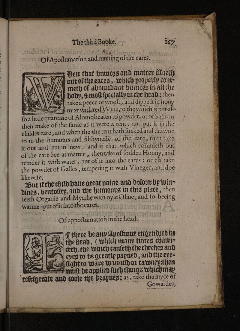 en : A, Meir : RIOT E LO SSVI DUS SDRAM tony Pie OF Apoftumation and running ofthe cares. | samen Hert that Humozsand matter Mluccy LY i meth of abounDdant Huntogs th all che HFe\\ body, ¢ mollipecialiytn the head: chen Y\Y/Saz) takea peece of wooll, and dippeitin hony f |} mixtvuthred Wine,to the whieh is putal (o alittle quantitic of Alome beaten to powder; ot of Saffron then make of the fame as it were a tents and pur it inthe childes care , and when the the tent hath fucked.and drawne to it. the humours and filthynefle of the eate, thien take, . it out and putin ‘new « andif that which commeth out. . of the eate bee as matter , thentake of fodden Honny, and temder it with water, put of it into the eares : or els take the powder of Galles , tempering it with Vineger,and doe likewife. Me But the chil hatte great paine and Dolour by win- nines, bentotity, and the humours tn this place, chen feeth Organie and Myrrhewith oyle Oliue, and fo becing watme: put ofit into the eares. ny, | Of appo Aumation in the head: On (Al | F cheve be arty Apoltunte erigendzcd tit |] PRL ies, the head, (which many tints chaun= | cet) the which caufeth thecheckes and Ls fee epesto be greatly payned , and Che epe- ix) |B Gabt to ware wannih o2 tawnep-ther SSS mitt be applied fuch things which may refrinerate and coole the beaynes; as. take py nye of owalacs,