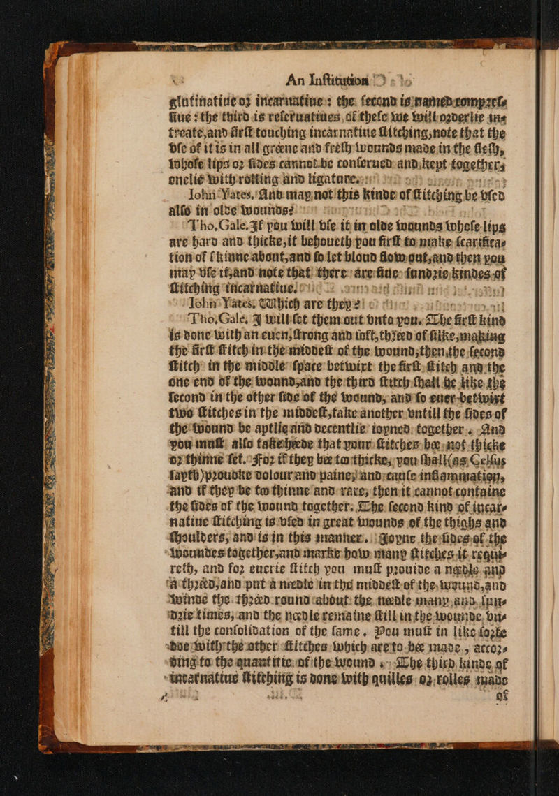 atutinatine 02 incariatine:: the. fecend isnaned-compzels fiue {the third.is reletuatiies, of thefe tue till overlie ans freate,and firtt touching incarnatine hitching note that the dle of itis tral greene and freth wounds mare in the fey, lobofe lips 02 fides cannot-be conterucd and: Kept togethers cnelié Withrdtting and h@ataresn yf ; John ‘Yates, 'Qnb may not) this kiabde of Gitebing be oie alfe in olde tyourds2 ' Tho, Gale. $f pou twill bf 16 it lve tvonnds tobefe lips are bard and thicke,it beboueth pou fir to make {cartficae tion of (kinneabout,and fo let bloud fot cut,and then pou nap Die 1Hand note that there. any iteo = wanhin a Titchitig ticarnatiues cn, . 7 ) Toh’ Yates, Tahieh are they: Bl or ThoGale ¥ willilot themeout onto yous £c The fir ft bine is done With an cuch, frong and inft, thied of fitke making fhe fir Kitch ratheantovet of the twound;then,the fecond Hitch: wi the middle fpace betiwirl the firl fitch ang: the one end of the wound,and the third Mitel thadl be tike the fccond inthe other five of the wound, and fo euer-betiwixt five Titthesin the middef, fake another wnttll the fives of the tvound be aptligand decentlic iopned: together. And pou inal: alfo fafielecde that your firtches be: not thicke 0? thimie tet. .3foz tf they bee tatiicke;- pou Mall(as: Gelfus faytb )proudke volourand paine; and:canle inflammation, ‘AND tf Chep be tw thinne and vace; thentt cannot.containe the fides of the wound together: She fecond Kind of incate natiue itchnig is:bfed in great wounds of the thiahs and Moulters, andistn thts amanher.. | Sopne thefiacgof the “Insundes fogether,and marke how many Ateches.ub requir reth, and foz euerie itch you mul proutde a ngble. anp ‘a thyed,and puta needle ithe middek-of the weund,and Wwinde the theebd round abdul: the tedle many,auo, tui Due times, and the nadle remaine Fill intheAwounde, Dive fill the confolivation of the fame. ou mu tir like doze bos wil the other itthes which areto-be mnade,, accozs “BING fo the quant ttteafthe wound «be thir. kinds of rol iaaiai atic ts bone With quilles: a2; tolles. made of