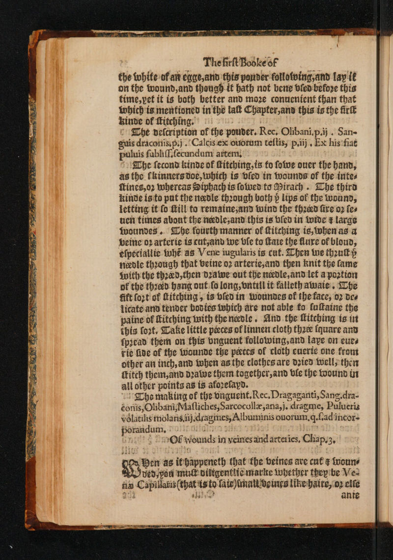 EP ET Dee RR PE ae. ) The firft Bookeof the tobhite of aixeane,and this ponder follotving,and lay tf on the twound,and thonad-it bath not bene bled before this fime,pet it is both better and moze connentent than that tbich is menfioncd in the tall Chapter,anv this is the firk kinve of itching. } | © Moe velcription of the pouder. Rec, Olibani,p.ij . San- guis dracotiis,p.j .’Calcis ex ouorum teftis, p,iij , Ex his:fise luis fablif,fecundum’ attem, Whe fecond kinde of Kitching, is fo foive over the hand, as fhe Ckinners doc, which is bled tn Mounds of the intes ftines,o2 whercas Siphbach is olwed ts Wirach . Whe thira Kinde isito pat the nedle through both p lips of the wound, letting it fo fill fo remaine;and wind the {heed fire 02 fes uci times about the nadle;and this is olen in tolde € lavas tvoundes .. lhe fourth manner of fitching te,toben as a beine 02 arferie ts catjanbd ive ble to Pate the flure of bloud, efpeciallic tuhe as Vene iugularis is cat. hen we thoukp | needle through that beine o2 arferic,and then knit the fame | {with the thaed,then dae out the needle, and let a pootion ) of the thred bang out ifolong,ontillit fallethawate. ihe = fift (ort of Kitching, is bfedin Wwoundes of theface, 02 bee licate ana tender bodies fobich are not able fo fullaine the paine of Kitching with the needle. And. the itching is it ibis fort. Dake litte péces of linnen cloth thee fquare anv {picad them on this buguent following,and laye on eure rie five of the wounde the pecces of cloth cuerie one from other ati inch, and toben asthe clothes are d310d wells then {titch theim,and Dealve them togethcr,and ble the toound tn all other points as ts afozelayd. “i Cho making of the buguent.Rec. Dragaganti, Sang.dra- éonis, OlibanisMaftiches, Sarcocullx,ana,j. dragme, Pulueris vélatils molaris,iij deagimes, Albuminis ouorum,q.fad incor- porandum. iighies 38 | nine nil) ¢ T saQ€ wounds in yeines and arteries, Chap,3, ve Ben as it bappeneth that the beines ave cnt ¢ foun CN vedjpou mil oiligentiic marke lobether theyibe Ve- an Capillatis(thatts to fate) imaltogines like baire, 02 clfe