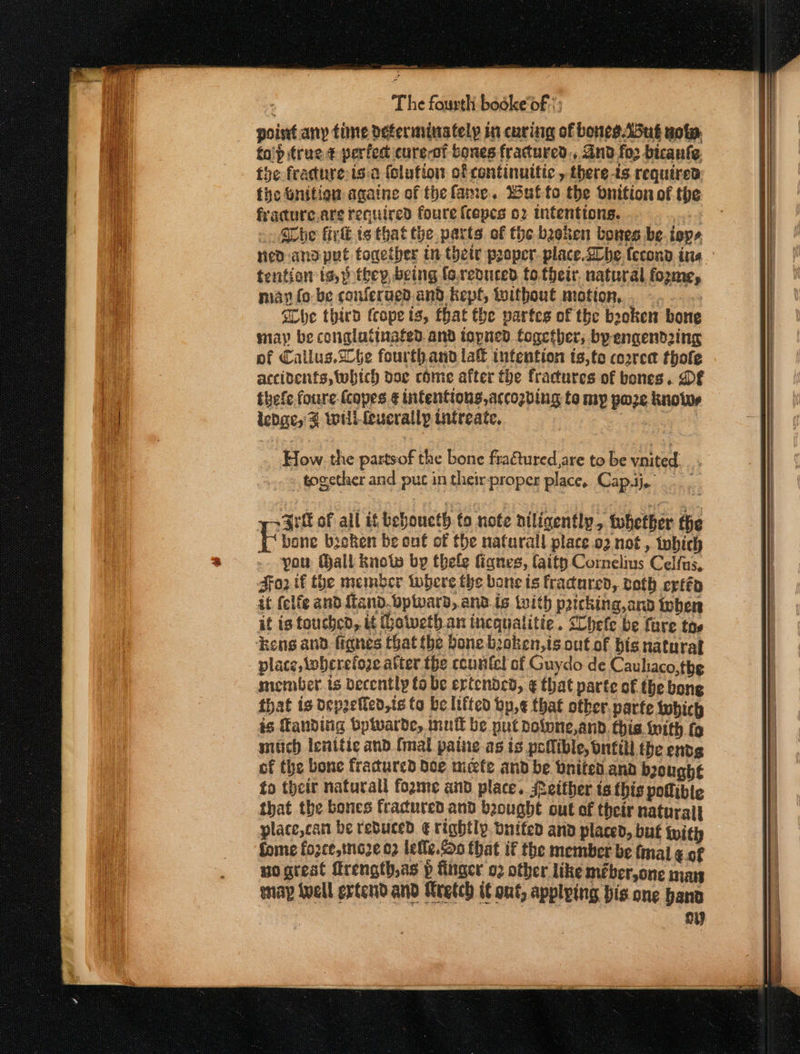 point any time deferminately in curing of bonies.Adug uote. fo'p true ¢ perfedt cureof bones fractured, And fo bicante the fracture isa (olution of continuitic , there ts required tye nition againe of thefame. Wulto the bnition of the fracure.are required foure {copes o2 intentions. : - She tiv ts that the parts of the boken bones be. iope red and put together in their proper. place.2be {econd ina tention is, ) they, being fo.reduced to their. natural foxme, man (o- be conferaed.and kept, without motion... -. | She third (cope ts, that the partes of the beeken bone may be congluttuafed and iopned together; byengendwing of Callus.he fourthand la€ intention ts,te correa thofe accidents, which doe come after the fractures of bones. DF thefe foure (copes ¢ intentions, accozding to my poze knots ledge, % will feverally utreate, | How the partsof the bone fra&amp;tured are to be vnited. together and puc in their proper place, Cap.ij. bone broken be ont of the nafurall place o2 not, twhich you Mall know bp thele fignes, faity Cornelius Celfus, For tf the membcr iwhere the bone is fracared, seth ertép it felfe and ftand. bptward, and. is twith pricking,ano tober it is touched, it (hotveth. an iicqualitie. Sobefe be fure tos ‘Keng and fignes that the bone boken,is out of bis naturat place, \obcrefoze after the countel of Guydo de Cauliaco,the member. is decently to be ertcndcd, ¢ that parte of the bone that is deprefled,ts to be lifted bp,¢ that other. parte twhich is Tanditig bpwarde, mufl be put dolone,and. this Inith fo mitch lenitic and [mail patne-as is pollible, bntill the endg of the bone fracured doe mete and be Onited. and brought fo their naturali fozme and place. either ts this podibte that the bones fracured and baought out of their natural place,can be reduced ¢ rightly. vnifed and placed, but with fome fozce,tno2e 02 lelle.o that if the member be fmal ¢ of noarest ftrength,as p finger 02 other like méber,one nan eiap Well extend and Kretch i ont, applying bis one band ny