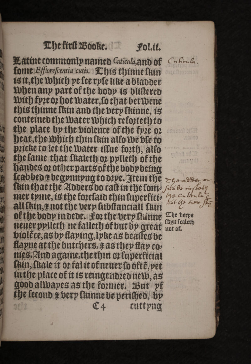 ID&efttflBdoftf. jToLrt. It 1 til II I It It Xatitic commonip named Gaa/Aanb of fomc Bffilorefcentia cutis. SCljistljinneflUn is it,tljc tbljtclj pe fee rpfe itfte a bladder lbftenanp part of tt)e bodp is buffered Ibitlj fp?e Oi Dot Vbater,fo tljat betlbene tljtstljmne lUtn and tljcberpfUinne, is cone etned tlje tbater tbiu ct) refojtetl) t o tlje place bp tl)e biolence of tfjc fpje o? ljeat,tl)e Vbljiet) eijtn futn alfo ibe bfe to pncftc e o le 111) t tbater tffue fojtf), alfo tfjc fame tfjat fftaletU oj pplietlj of tfjc Handcs oj otljer parts oftlje bobpbeing -- ' todjpe.3tem tfte *•£*. Docaffintbefom* /*•-&> '-A(f mer tpme, is tlje fojefaid turn fuperfict* all tUin,f not tlje berp fubffanriau ftun oftDebodpmdede. foitIjebcrpfUinne neuerppiietlj nefalletljofbut bp great 2*** btoicce.as bp flapstig,lpbc as beaftes be flapne attfte bntcljers, fas tljep flap co« ntfs.3tnd agame.tUe ttjtn oj fuperftcial ffetti, fftale it oj fal it of newer fo oft c, pet tntfje place of it is teingenojeo ttem, as good allbapes as t&e foitucr. usut pf $e fecond * berp fUinuc be periled,1 bp