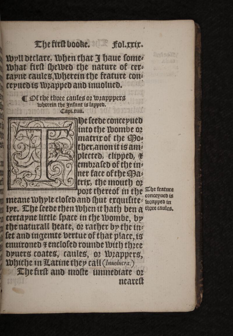 Eheffrttboolte. Jfolicjrtjc ) Htpll Declare, Vbljcn tljat 3 haue fome< it ibbat ftrft Q)cU»eD tljc nature of ccr* taptte tattles,Wherein tt)e feature con* ccpueDts W?appeb attD inuolncb. k c tty ttytt caufeg o* tojappperg totjcrctn ttje infant ts lappco. '' - '■ '*J? i » ( A. • 0 • 0 0 * . Capuutu l^efccDcconccpucD intotheibombeot matrir of the C0o* thcr,anontttsam* plerteo, clippeb, f ttnbjafeD of tljeirn tier face ofthefltDa* ttijc, the mouth o; ott thereof in thefcature meant WhpledofeDanD (ljut ejequiftte* lujapiieD in it ipe. 3Ehe feebe then When tt hatlj bett a tl)Jte““lcB- ■a certapne little (pace in the ibombe, bp it the naturail heate, ot rather bp the in* fet anb ingemte bertue of that placets enttironeb ? enclofco routtbe With thite bpuers coates, cattles, oi Wrappers, Winch e tn Eatinethep call(/»«o/«cw.) 5Ei) e ftrft attb molte iutmebiate or mi ft ncareft