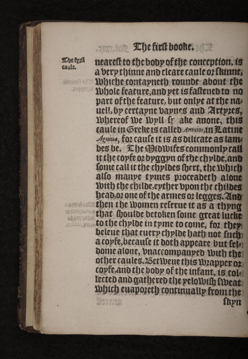 a Deep thiune a no cleare cattle 02 fbinne, Ufttche contapneth tottttDe about fljc no pact of the feature, but onlpc at the na« ucl!,bp ccrtapnc bapnes anb ^rtptes, thereof ibe ttipil fr abe anonc, ttjts tauie in ©rebe ts eaUeb^»w««,itt Hattne Jtntm, fomufeittsas bt u rate as lam* besbe. lEpe fiDtottufes commonly tall ttthecopftotbpggpn of the chPlDe,anb fome call it tftc tribes ftett, the Kbftt eft alfo tnanpe tpines ptocrabeth alone then tpe women referue it as a thpttg that ftoulbe betoben fotne great luebe to tt>e chplbe in tpme to eotne, fot tfjep ...  notfueft: PHHHPHH L. borne alone, tmarcompanpcb tbut) the other caules.25ettbene this Vbjapper 02 copfe^tnbthebobp of theinfant, is coh lecteb anb gathtreo the peiotbift ftpeat