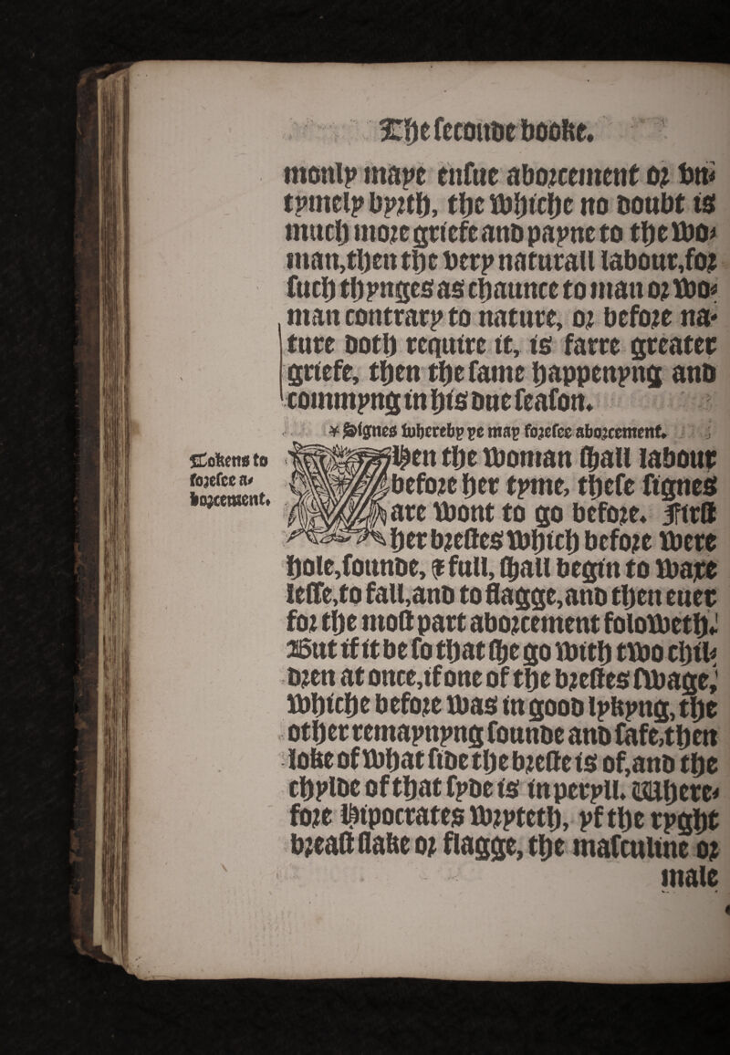 Xfte feconbt boofte. SCofeettsto fojefce n* iojccmciit. mcnlp mape enfue abozcemetit oz bn< tprnelp bpzth, the fbhtche tto Doubt is much moze griefc anD papne to ttjeUJO^ man,then tfic berp natutau labour,foz fuel) tljpngesas cfiauncc to titan oz mo* man contrary to nature, oz befoze na¬ ture Dot!) require tt, is farre greater grtefe, then the fame happenpng anb commpng tn fjts Due feafon. * foberebp ye map fojefee abojeemettf. j l^ett tljc moman IJall labour before Iter tpme, ttjefe ftgncs are mont to go befoze, iftrtt herbzeftesmbtcb before mere hole,fotutbe, a full, (Jail begtn to mate ielfe,to fall,anb to flagge,ano tljctt euer foz tlje mod part abozeement folometJJ aeut if ft be fo that ffje go mtth tmo etrth ozen at once,tf one of tfte bzeftes image; mbfeje before mas mgoon ipbpng, the other remapnpng fonnoe anD fafe,th eu lobe of mhat ftDe the bzette is of,anb the chplDe of that fpbe is inperpll. ifliljere- foze Ibtpocrates mzpteth, pftherpght bzeaftflahe oz fiagge, the mafculfne oz male *
