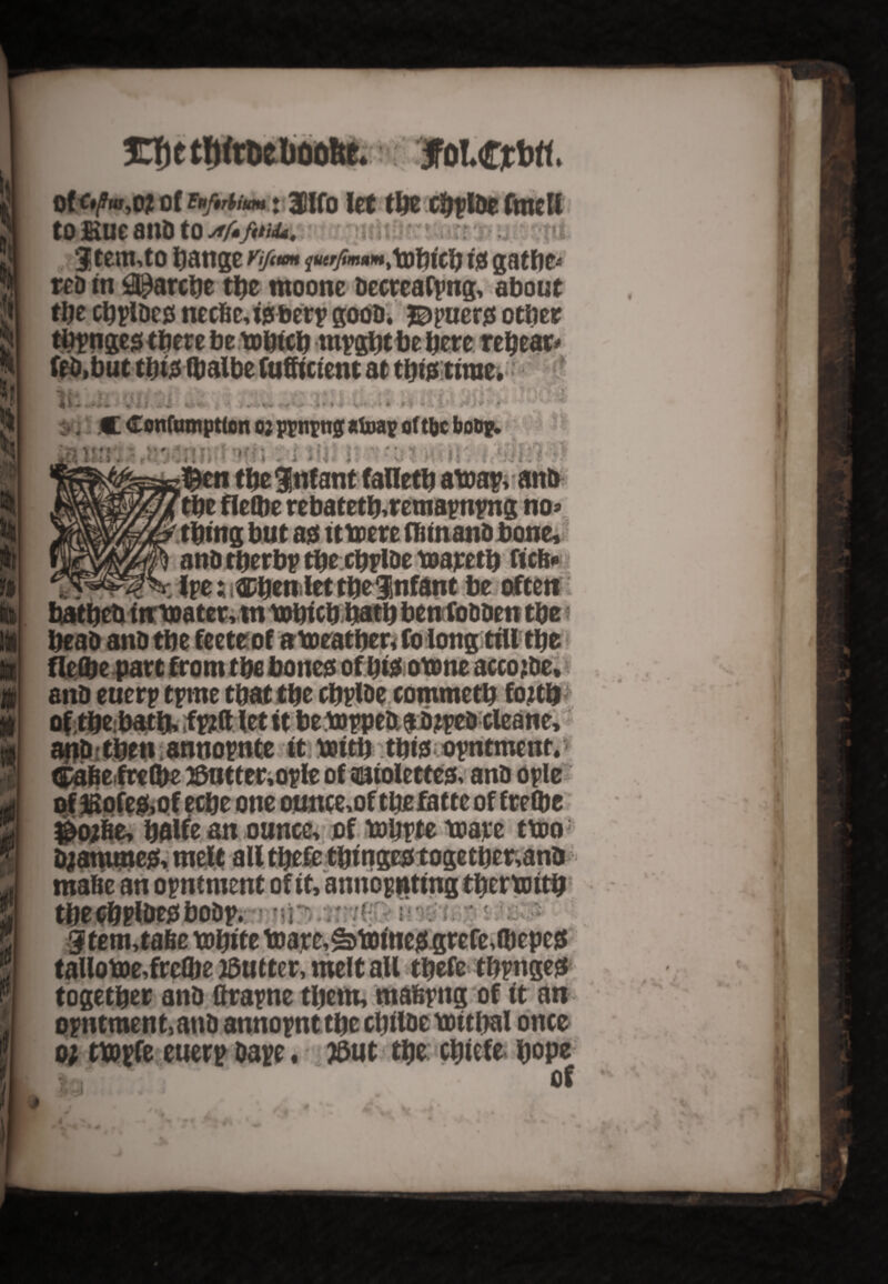 r. If* P I* A 11 ! ofc»/?«i,o? of z»f*rbiuM ♦ 30Ifo let the chplDe frncll to Hue anD to jtfcfituu. wh t ;r: y rtf Item, to hange Vifim tg gathe¬ red in Marche tl)z rnoone Decreafpng* about the chplDe0 necfie,t0berp goon* jDpucr# other tbmges there betohtch tnpghtbe here rehear* feO,buttht0(balbefufftctentattht0tirae. ' Tkk*\ it si \tii f ' t yt •#***-; • v»u #{ y\ i \ •' 4 i • • i « 4 f 4<i i- (Mb f 'i . i ty < > ’> 4 » » 4 V ** * • fS */• i J* y* .C Confamptton o; ptnro afoap aftbc boDp. $cn the Infant falleth atoap, anb the flelhe rebateth,remapnpng no* ■thing but a0 t ttoere fhtnano bone* anD therbp the chplDe toareth ficfi* freshen let the Infant be often batheb intoatervin tohich hath ben foDDen the * heao anD the feeteof a toeather, fo long till the flelhe part from the bone0 of hi0 otone accojDe* anD euerp tpme that the chplDe commeth fojtlj; *4 \ 4 j t anDithtn annornte it omb tbisoyntmenr. Cafiefrelbe 28ntter,ople of mtolette0, anD ople of Hofe&of eche one ounce,of tbefattc of frelbe #ojfie, hfitfe an ounce, of rohrte trace ttoo D;amme0, melt all thefe thinge0together;anD mafic an opntment of it, annotating therxotth thechPlDeoboDp. utt u < lau& Itenuafie white tDarc,^tome0grefe,O)epe0 taUotDe,frcO)e butter, melt all thefe tbpnge* together anD (frame them, mafiyng of it an opntment,anD annopnt the chtlDe withal once o; twpfe euerp Dape • ?5ut the chiefe. hope of % •