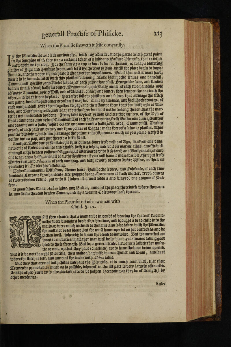 When the Pleurifie (lieweth it felfe outwardly, I IF the Bleutifie fl^elo it felfe outtoarhlij, toltlj aup tmm, anu tl;e pactie f^let 1) great patite m the touching of it, t^cn it is a cectaine f ofeen of a falfe ano 51i5aftaco f lcucifie,that is fetlen outtoarhlpontlicnbs* jf o? the fame, 10 a cup oj bote to be fettheceon, o^^tolapabliHecing fila»aer of ifigo ano QpuftacD fttDe0, ano let it Ipe thereon fo long,bntiU the place begin to impo^ Lmate> ano then open itj aho heale it lihe as other impoftumee, mt if the matter toare harb^ tbenitiBtobematurafeotoiththisplailtcrfolloUimgiMe^oUihocfee leaue0 one hanofuU, Cammomill, ^elilot, ano miolet leau00, of each haUe a hanofnll, if enegrahe feoe, ano llinfeo beaten fmall,ofeachhalfe an ounce, 3iBeancmeale,ano llBarlp meale, of each ttoo hanoful0,oplb offlnate aimonb0, ople of ^ill, ano of ^aiolete, of each one ounce, then temper the onetotth the other ano fo lap it on the place. ipereafter folloto plaiftero ano falneo that aOtnage the Hitch ano oaine be it of tohatfoeuer occaGon it map be, 2Cafee ^allotoee, ano^olUhocheroofe0, of each one hanofull, feth them together to pap, ano then Hampe them together toith ople of mio^ Izts ano l^arotoeo gceafe,ano fo lap it on the foje ♦ but let it not lie to long theton,that the mat^ ter be not maturateo tiofoone, 3ltem, take ^Dple of pellotn tiaioleto tlno ounces, of the £0ple of ftoffite 0lmonO0,ano ople of Cammomil,of each halfe an ounce,frelh HSutter one ounce,^aHton oneojagmeanoahalfe, tohiteMare oneounceanoahalfe,^iU faoe, Cammomill, mtkes arcafe, of each halfe an ounce, ano mk polte of eggeo: mafee thereof a falue 0? plaifter. pouUio following, ooth much alltoage the paine: tahe ^;anne as much as pou pleafe, feeth H m ^ine Onto a pap, ano put thereto a little &alt. ^ Another, SCaheOnripe Callao ople th?a ouncessfourefrelhpolbsofCBgs, Saffron one o?ag. neto opie of Kofes one ounce ano ahalfe, feeth it a tohile, ano fet it on toarme alhes, ano ttir Inell amonaft it the beaten polfecs of CBgges: put aftertoaros Unto it starch ano Barlp meale,of ea^ one O’ag, ano a halfe, ano laft of all the ^afiton: if pou mill hane it mo?e forcible, then put ftelh SButtcr to it, ano Bdellmm, of each one o;ag* ano feeth it mith mom ftoeetc «ne, as as vouoefireit,^jbfcthisfolloming, , ^ ^ ICafee Cammomill, SDillfeeof, tKenushaire, l^olUhoche feeOes, anOifolefoofe,of each tmo hanofuls,Currans th.:ahanofuls,firepoppieheaos,fireoancesof frelh iButter, rrrhi* ounces of finite fooocn^isaine, put Onto it (Inhen all is toellfdooen ano b^apeoj one ojagmeof ^af# ^*^°agooD falue, SDahe falue, ano JButter, annointthcplacethcretoith toherethepaini^ is, ano ftrelu thereon beaten Comin, ano lap a toarme ColetDoo^t leafe thereon* When the Pleurifie taketh a woman with Child. §. 12. ► if it then chance that a tooman be in oonbf of bearing the fpace of ttoo mo^ ' nethSjtoerc brought a beo before her time, anb brought a oeao chilo into the , U>ojlo,ojmere much inclineo to the fame,ano fobe taben toith the pleurifie, i ihe muG not be let blouo,but (he mull haue cups fet on her buttotbes,ano be picfeeOtoell, toherebptb o^atotheblouoootontoaro* Kttoomen that are ' toont to mifeariein hall,thep map toell be let blooo,pet altoaies tabinggooo heeo to their llcength*515utfe? a generallrule, alltoomen (albeitthepmiffa-^ tie o;^ not, o;jthat thephaueconceiueo) aretohauefheltuertjeine openeo* 5!Butifit be nottheright pleurifie, then make a bag toith toarmeipillet ano3i5;an, anolapit toberethemtchi3felt,anoannointthebacketoith^/fWalue* iButthep that arenottoithchiloe ano haue the pleurifie, it is much counfelleo, that their temes be p?ouobeo as much as is polTible, toheceof in the fift part is berp largelp oifeourfeo* ;3no the other (euen as is alreaoie faio) are to be holpen (accotoing as thep be of firength; bp other meokines* kuleiJ