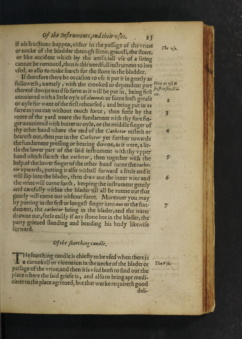 orneckc of the bladder through fiime^grauelljthe done, or like accident which by rhe artificial! vfe of a firing cannot be remoued,fhcnis thi^needful!inftrument to bee vfed, as alfo to make fearch for the done in the bladder. If therefore there beoccafion to vfe it put it in gently as followeth, namely, with the crooked or dependent part thereof downeward fo farre as it w ill be put in, being fird annointed with a little oyle oialmonds or fonie fredi o^reafe or oyle for w'ant ofthe fird rehearfed, and being put in as farreasyoucan without much force, then feele by the roote ofthe yard neere the fundament with thy forefin¬ ger annointed with butter or oyle, or the middle finger of thy other hand where the end of rhe Cathetor redethor bearethout,thenputinthe Cathetor yet further towards the fundament preding or bearing dowme, as it were, a lit¬ tle the lower part ofthe faid indrument with thy vpper hand which daieth the cathetor ^ then together with the help of thelower finger of the other hand furnethec4/^<r- vpwards, putting it alfo w'ithall forward a little and it will flip into the biader, then draw out the inner wier aqd the vrine will come forth, keeping the indrument gently and carefully within the biader till all be runne out that gently will come out without force. Morcouer you may by putting in the fird or longed finger intoa^o or the fun- dament, the cathetor being in the biader,and the water draWne o ut, feele ea lily if any done bee in the biader, rhe party grieued danding and bending his body likewife forward. rhi Ofthe fearching candle^ THefcarching candle is chiefly to be vfed when there is . a carunfceli or vlccratfon in the nccke ofthe bladeror palfage ofthe vrine,and then iris vfed both to find out the place where the faid griefe is, and alfo to bring apt medi¬ cines tathe place 3grieued3 but that worke requireth good deli--