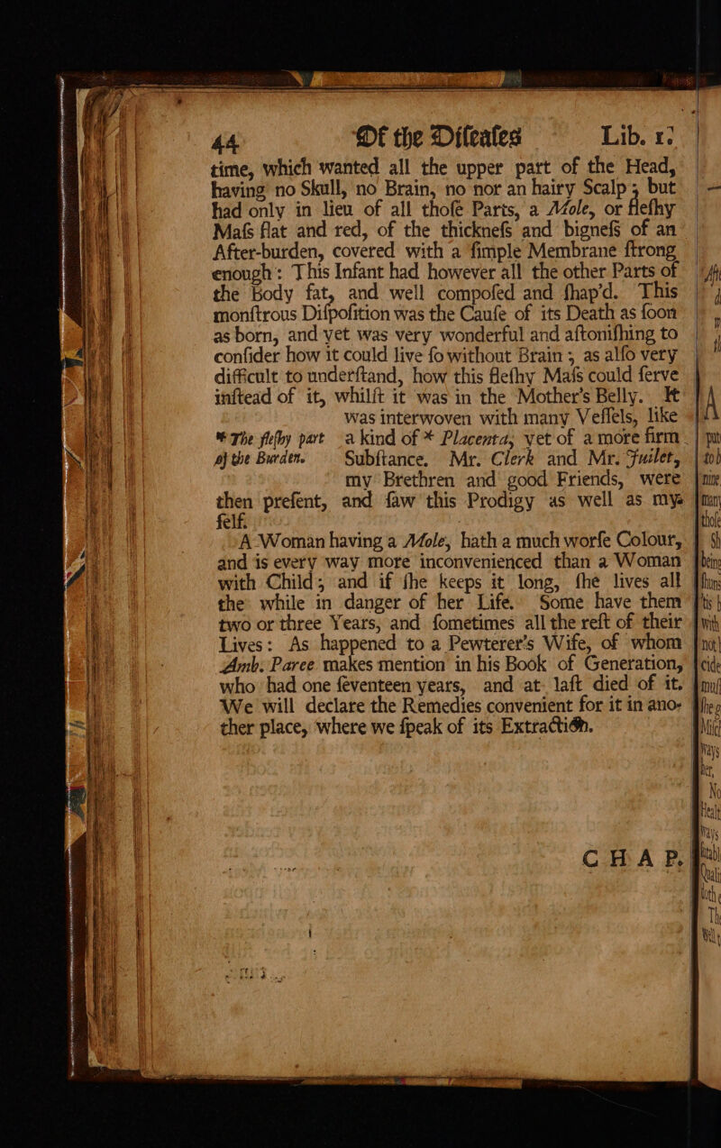 he eT rma NESE a 9 HUENEME 1 CAPE oye RE prose % =: FS Sa riage” ate time, which wanted all the upper part of the Head, having’ no Skull, no Brain, no nor an hairy Scalp; but | — had only in liew of all thofé Parts, a Azole, or flethy Maf flat and red, of the thicknefS and bignefS of an” After-burden, covered with a fimple Membrane ftrong enough: This Infant had however all the other Parts of ff the Body fat, and well compofed and fhap’d. This |, monftrous Difpofition was the Caufe of its Death as foon as born, and vet was very wonderful and aftonifhing to confider how it could live fo without Brain; as alfo very | difficult to underftand, how this flefhy Mafs could ferve inftead of it, whilft it was in the Mother's Belly. It was interwoven with many Veffels, like /| % The flefhy part akind of * Placenta, vet of amore firm _| pf the Burden. Subftance. Mr. Clerk and Mr. Fuslet, | my Brethren and good Friends, were po prefent, and faw this Prodigy as well as mys elf. . | A Woman having a Mole, hath a much worfe Colour, | and is every way more inconvenienced than a Woman Jb with Child, and if fhe keeps it long, fhe lives all | the: while in danger of her Life. Some have them Ji two or three Years, and fometimes all the reft of their Jw Lives: As happened to a Pewterer’s Wife, of whom | Amb. Paree makes mention in his Book of Generation, [cid who had one féventeen years, and at- laft died of it. | We will declare the Remedies convenient for it in ano: ther place, where we fpeak of its Extraction. me