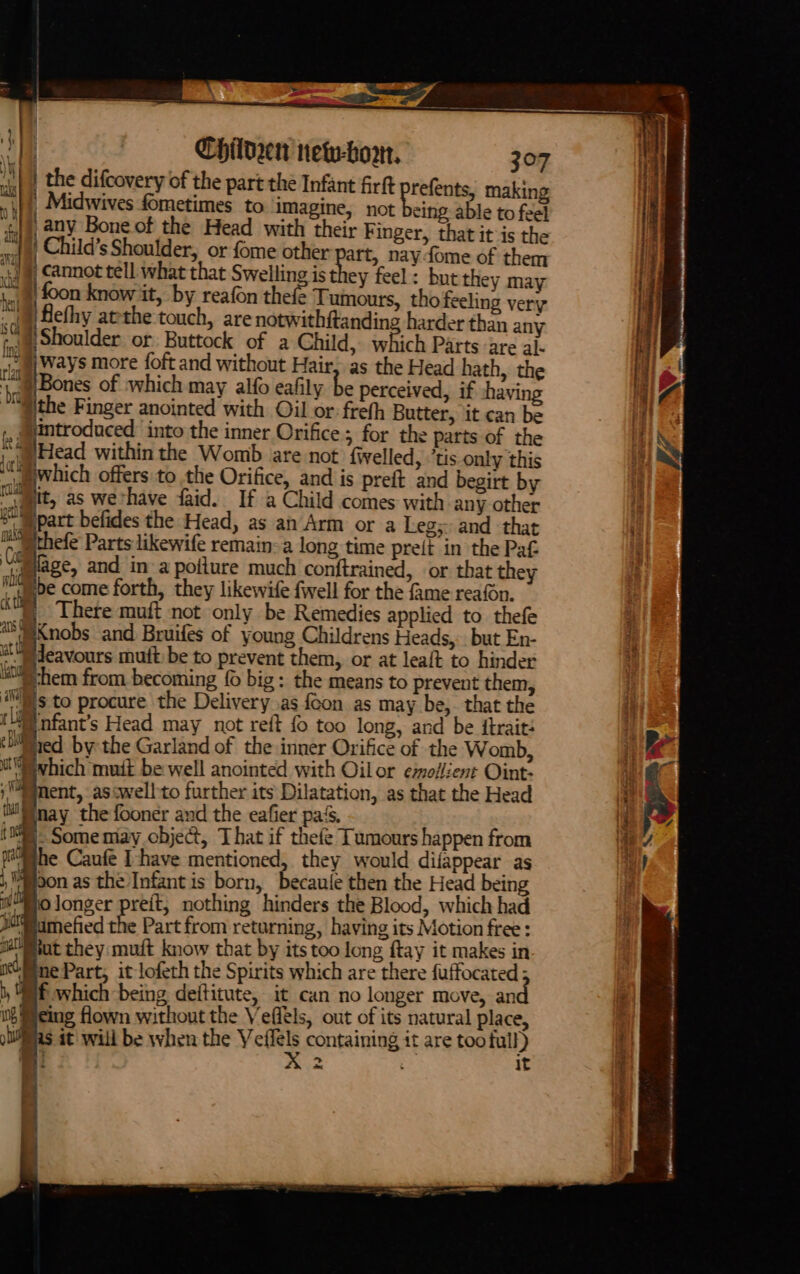 aa ee Hy) : Childe netw-bort. 307 i) | the difcovery of the part the Infant fir refents, making itt, Midwives fometimes to imagine, not being able to feel ot any Bone of the Head with their Finger, that it-is the | ) Child’s Shoulder, or {ome other art, naydome of them i.) §, Cannot tell what that Swelling ist ey feel: but they may 1, §) foon know it, by reafon thefe Tumours, thofeeling very nbesy att Aw 7 ul (a flefhy atthe touch, are notwithftandino harder than any 7a Shoulder or Buttock of a Child, which Parts are al- ways more foft and without Hair; as the Head hath, the Bones of ‘which may alfo eafily be perceived, if shaving i. ithe Finger anointed with Oil or frefh Butter, it can be fmtroduced into the inner Orifice; for the parts of the (= th Sb ine lal SBE) hen ‘Head within the Womb are not fwelled, ’tis only this Which offers to the Orifice, and is preft and begirt by ie ‘it, as wethave faid. If a Child comes with any other ® mpart befides the Head, as an Arm or a Legs and that allt ehefe Parts likewife remain-a long time preit in the Paf iifage, and in: a poilure much conftrained, or that they ie ibe come forth, they likewife fwell for the fame reafn,. ae ; There muft not only be Remedies applied to thefe “deXnobs and. Bruifes of young Childrens Heads,.. but En- tt) deavours muit:be to prevent them, or at leaft to hinder i) hem from becoming fo big: the means to prevent them, is to procure the Delivery as {eon as may be,. that the IU nfant’s Head may not reft {0 too long, and be itrait: euliied by the Garland of the inner Orifice of the Womb, it vhich mutt be well anointed with Oilor emollient Oint- nent, asiwellto further its Dilatation, as that the Head il nay the fooner and the eafier pa‘, B. Some may object, That if thefe Tumours happen from he Caufé Ihave mentioned, they would difappear as don as the Infant is born, becaule then the Head being Olonger preft, nothing hinders the Blood, which had jMSamefied the Part from returning, having its Motion free: mat they: muft know that by its too long ftay it makes in ne Part, it lofeth the Spirits which are there fuffocated ; Mf which being deititute, it can no longer move, an being flown without the Veflels, out of its natural place, Meas it will be when the Veffels containing it are too full) |B A: it baie rah Pte ECM, Tom OB BB TIN Cs A tle