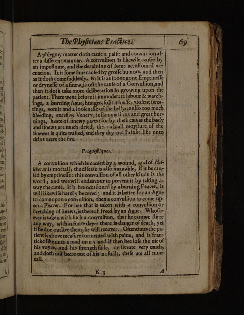 A phlegmy matter doth caufe a palfie and convuiiion af- ter a differentmanner. Aconvulfion is likewife caufed by an impoftume, and the detaining of fome accultomed va- cuation. Itis fometimecaufed by groffle humors, and then as it doth comefuddenly,, fo it is as foone gone.Emptinefle or drynelle of a finew,is oftthe caufe of a Convullion,and then it doth take more deliberation in growing upon the patient, There went-before it immoderate labour &amp; watch- ings,.a burning, Ague, hunger; (olitarinelfe, violent (wea- bleeding, exceflive Venery; inflammations and great bur- nings, heate‘of finewy parts: for by.thete, caules the bedy and finews.are much dried, the,.radicall. moyfture of the finewes is quite wafted, and they dry. and fhrinke like unto skins neere the fires: 9: yo efotai du : Prognoftiques.° A convulfion which is caufed.by a.wound, and of Hel- leborus is mortal]; thedifeafe is alfo incurable, if it be cau- fed by emptinefle : this convulfion of all other kinds is the worft; and wee will endeavour to prevent it by taking a- way thecaufe. If it bee occafioned by.a burning Feaver, it willlikewife hardly becured ; and ic is better for an Ague to comeuponaconyulfion, thena convulfion to come up- ona Feaver. For hee that is taken; with a convulfon or apr | ftretching of finews,is thereof freed. by an Ague. Whofo- ts | ever istaken with fuch a convulfion, thathe.cannot ftirre qnet) any way, within foure dayes there is-danger.of death, yet evel} | | ifhedoe outlive them;he will recover. ;, Oftentimes che pa- oot} : tientis above meafure tormented with paine, and is fran- hit! his voyce,,and his: ftrength faile, or fweate very much, ibe | es doth caft beere out of his:noftrils, thefe are all mor- vf 28 | a . thea * ; . mae a a eg aga SI A