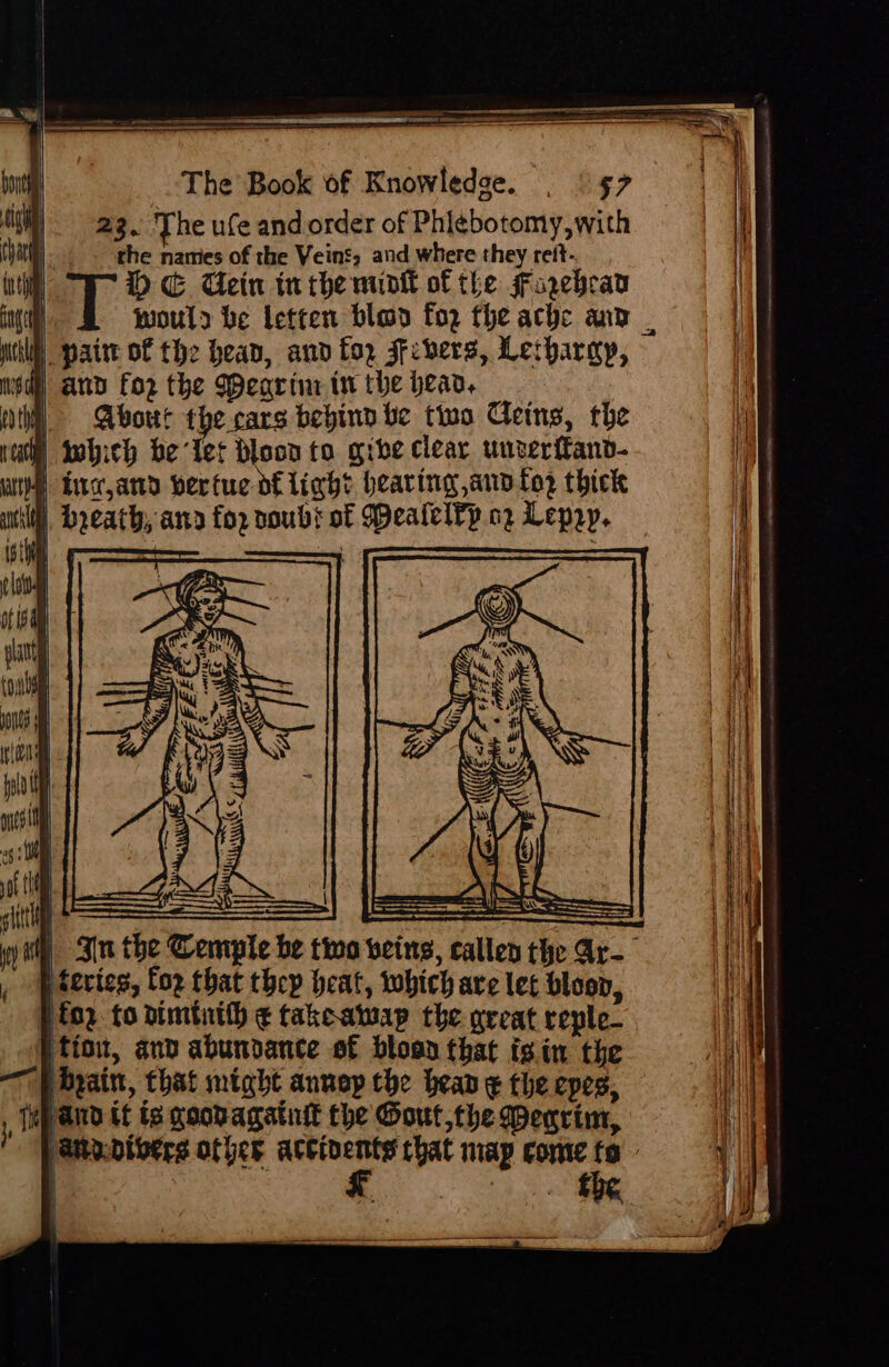 23. The ufe and order of Phlebotomy, with i: the names of the Veint, and where they reit- nt 1 E Uein tn the mink of the Fogebrar would be letten blad fo2 the ache ann | | paitt of the heap, and fo, jfcbers, Lerhargy, dh and for the Weavine in the hear. | About the cars bebinn be two Cleins, the ra) Iobich be “Let Doon to gre clear unverffand- wie Encjamd bertue o€ lich? hearing and fo2 thick util), breath, ana for voubs of Pealelkp oz Lepry, iste | Sin the Cemple be two veins, callen the Ar- f ievies, Coz that thep heat, wobich are let bloon, for. to dimtith ¢ takeawap the great reple_ ‘tion, and abundance of blood that isin the ——Bbpain, that might annep che bean ¢ the epes, pand if ts goobagatnit the Gout,the Wearim, Arootbers of ber eg that map conte fo ¥ Eb