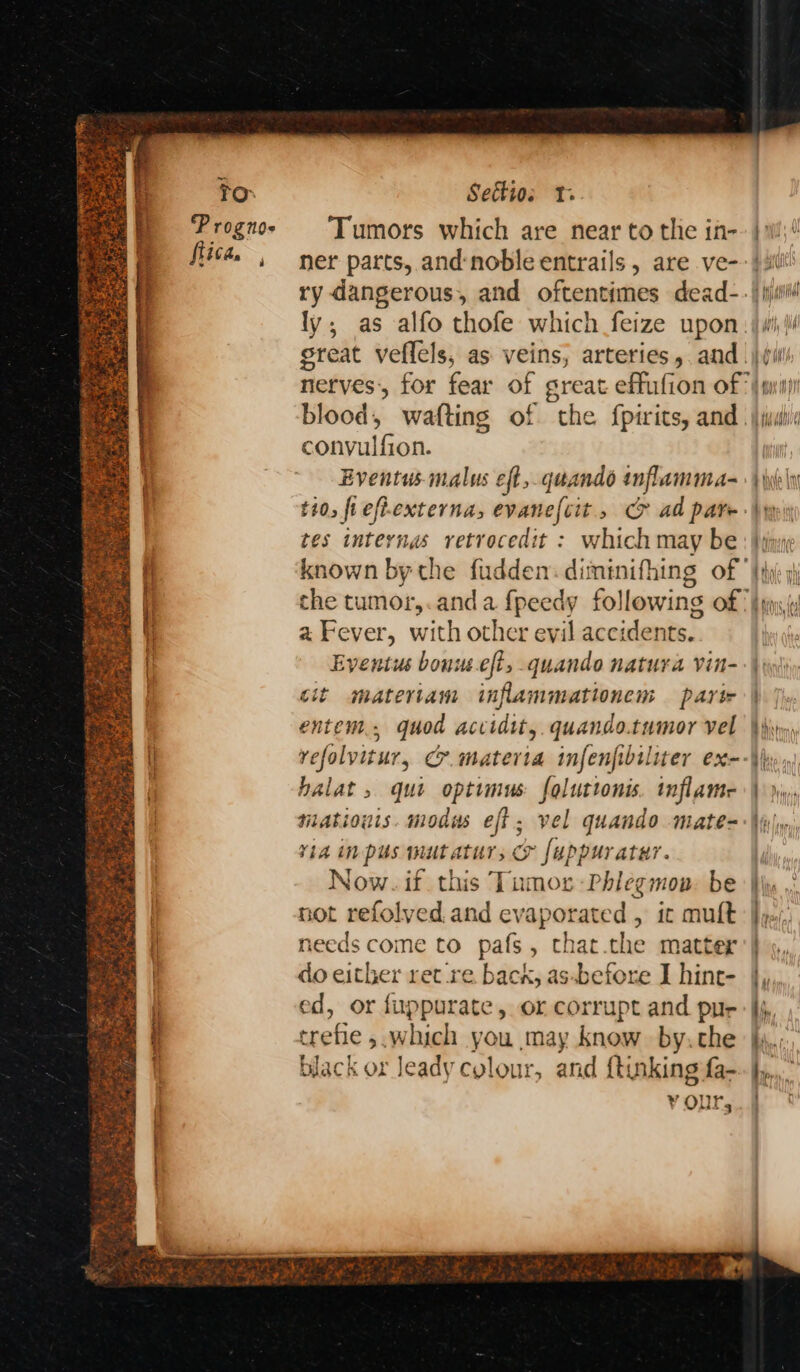 s eameatas : ee: At fica. , Settios 1. Tumors which are near to the in- ner parts, and‘noble entrails , are ve- ry dangerous, and oftentimes dead- great veflels, as nerves’, for fear of gre blood, wafting of convulfion. Eventus malus eft, qt and inflamma-~ tes ist aids retrocedit : which may be known bythe fudden dimenifhing a Fever, with other evil accidents. Eyentus bonuseft, quando natura vin- cit materiam inflammationem partir entent.. quod accidit, quando.tumor vel halat , qut optimus falustoni inflame niatious. modus eft; vel quando mate- Yi in pus mut at vat &amp; fuppur atur. Now. if this Tumor -Phlegmon. be not refolyed and aaa » ic mult needs come to pafs, that.the matter do either ret-re. bacx, as-before I hine- ed, or fuppurate, or corrupt and pur crefie &gt;.which you may know. by.the black ox leady cylour, and {tinking fa- black ? 1? ‘ Py abbas DUA WP