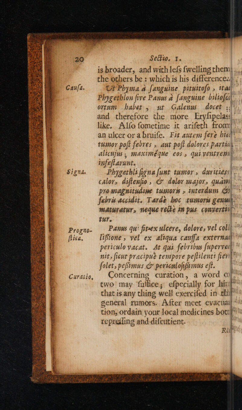Gaufa. S12 Nhe Progio- ftica. Settio. 1. is broader, and with lefs {welling them) ,,,. the others be : which is his difference..) ,'; Ci Phyma a fanguine piruitofo , ita’ Phygethlon five Panus a fanguine biliofes, ortum habet, ut Galenus docet be and therefore the more Eryfipelass like. Alfo fometime it arifeth from. an ulcer or a bruife. Fit autem fere hud tumor poft fedves , aut poft dolores partis. alicujus, maxtmeque eos alba infeflarunt. Phygethlifigna {unt tumor, duvitiess) calor, diftenfo, < dolor major, quail) promagnitudine tumors , interdum @)) febvis acciudit. Tarde hoc tumoris genuih. maturatur, neque vette in pus converttiy | : tur. Panus qu’ fitaex ulcere, dolore; vel coll) lifione , vel ex aliqua canffa externas (\' periculo vacat. At qua febribus uperven nit, ficut pracipue tempore peftilentt fier” folet, pefimus & pevicesloje faimus eft. Concerning curation, a word oj, two may ‘futtice; efpecially for lira? that is. any thing well exercifed in eli general rumors. After meet evacuaal “! tion, ordain your local medicines bot ri reprediing and-difcutient. “ oleae