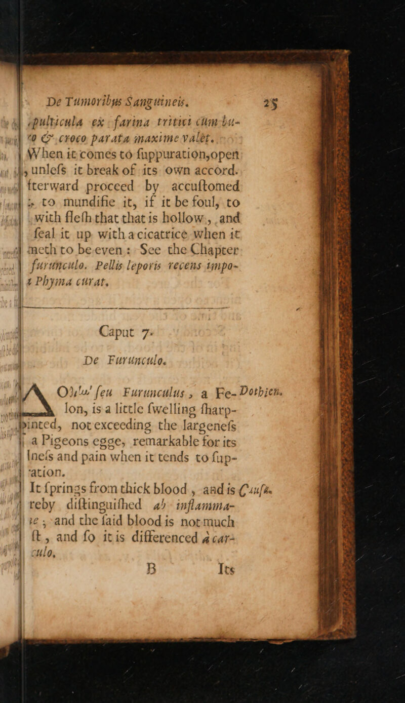ppulticula ex farina tritit cumbu- 0 &amp; crKOco parata maxime valet. W hen it comes to fuppuration,open 4, unlefs ic break of its own accord. fterward proceed by accuftomed iF + to mundifie it, if it be foul, to 1 with flefh that that is hollow., .and | feal ic up. with acicatrice when it ; meth to beeven: See the Chapter | urunculo, Pellis leporis recens tmpo- ) 4 Phyima curat, oo FS Caput 7: De Furunculo. i ula’ feu Furunculus , a Fe-Dothien. c | lon, is a little {wel ling fhar p- pinted, novexceeding the ieagaine i a Pigeor 1s Ese, remarkable } for its | Inefs and pain when it tends to fup- }) ation. | It {prings from thick blood. , aad is (u/s i teby diftinguifhed 4) inflamma- }) ¢; and the faid blood is notmuch | ft, and fo itis differenced @¢ar- 1) culo, B Its
