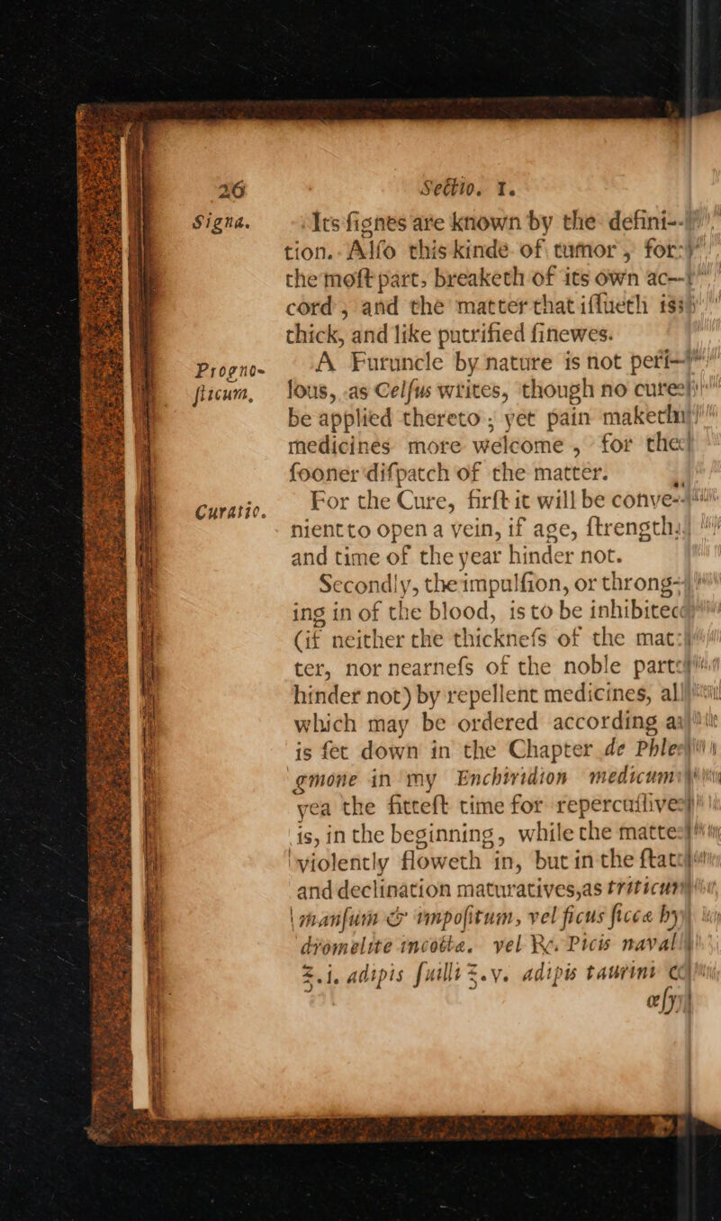 Signa, Progno- fiicum, Curatic. Settio. Te Its fignes are known by the: defini-- tion. Alfo this kindé. of tufnor , for:)’ the moft part. breaketh of its own ac} cord, and the matter that iffueth iss} thick, and like putrified finewes. A Furuncle by nature is not peri) lous, as Celfus writes, though no cures}i! be applied thereto ; yet pain makethn}/' medicines more welcome , for thee’ fooner‘difpatch of the matter. + For the Cure, firft it will be conve--* nientto open a vein, if age, ftrength,) and time of the year hinder not. Secondly, the impulfion, or throng-\ ing in of the blood, isto be inhibitec (if neither the thicknefs of the mat:| ter, nor nearnefs of the noble partcyii hinder not) by repellent medicines, all)!‘ which may be ordered according aa) is fet down in the Chapter de Phlee}ii' ‘gmone in’ my Enchiridion medicumiyisi yea the fitteft time for repercuilives}!) is, inthe beginning, while che mattes}! ‘violently floweth in, but in the ftatoj and declination maturatives,as tréticunm (ii | manfum &amp; vmpofitum, vel ficus ficce by diomelite incotta. vel Re Picis navall Z.j, adipis fuilliZ.v. adipis taurint CO Mi ayy i!