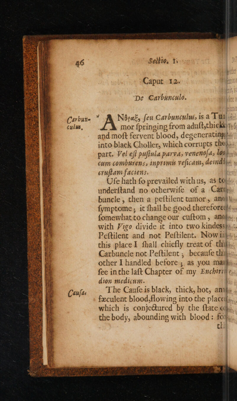 Caufas Caput 12. De Carbunculo. mor f{pringing from aduft,thicks) mt and moft fervent blood, degenerating) into black Choller, which corrupts tha}, part. Vel eff puffula parva, veneno{as, lov, cum comburens, inpremis veficam, deimadlyy y cvuftam faciens. | Ufe hath fo prevailed with us, as tei) underftand no otherwife of a Catt) buncle , then a peftilent tumor, ana} {ymptome, it fhall be good therefored fomewhatto change our cuftom , anni. with Vigo divide it into two kindess}i\,:, Peftilent and not Peftilent. Now ii}), this place1 fhall chiefly treat of chijj Carbuncle not Peftilent , becaufe thi}, other I handled before; as you maaijj,; fee inthe laft Chapter of my Enchiriit dion medicum. The Canfe is black, thick, hot, anvj feculent blood,flowing into the placedy,,,, which is conje&ured by the ftate ogy, the body, abounding with blood :. fea tl