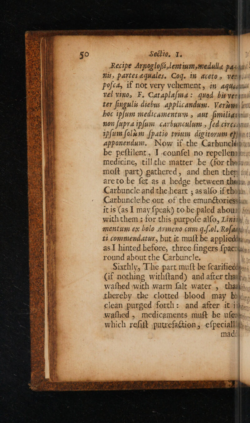 Recipe Arpoglofilentium,medulle pati Nis, partes aquales, Cog. 1m Aceto, very)! pofca, if not very vehement, im aqugehil vel vino, F. Cataplafma: quod. bis-ver yiwil ter fingulis diebus applicandum. Veergwma\ \ hoc ipfum medicamentum , aut fimiliasylu non fupraipfum carbunculum., fed.ctrexsdmu ipfumfolum fpatio trium digitorum ep)yei apponendum. Now if-the Carbuncldibiin be peftilent, I -counfel no repellenajn:y medicine, tillche matter be (for thabaw moft part) gathered, and then thepy ti areto be fet as a hedge between thai, i Carbuncle anditheheart ; as alfo if thably Carbuncleibe. out of the emun&oriessh« itis (as I may {peak) to be-paled abowa) i withthem ; for this purpofe alfo, Lintihy mentum ex bolo Armeno cum q.f.ol. Rofadyl tt commendatur, but ic mult be applieddbiyy, asI hinted before, three fingers {pacciw; round about the Carbuncle. | Sixthly, The part muft be fcarifieddhy), (if nothing withf{tand) and after chal wafhed with warm fale water , thaabi) thereby the clotted blood may bd)j,, clean purged forth: and after it diy, wathed , medicaments muft be ufeah, which refitt ,putrefaction, efpeciallidy,.. mad)