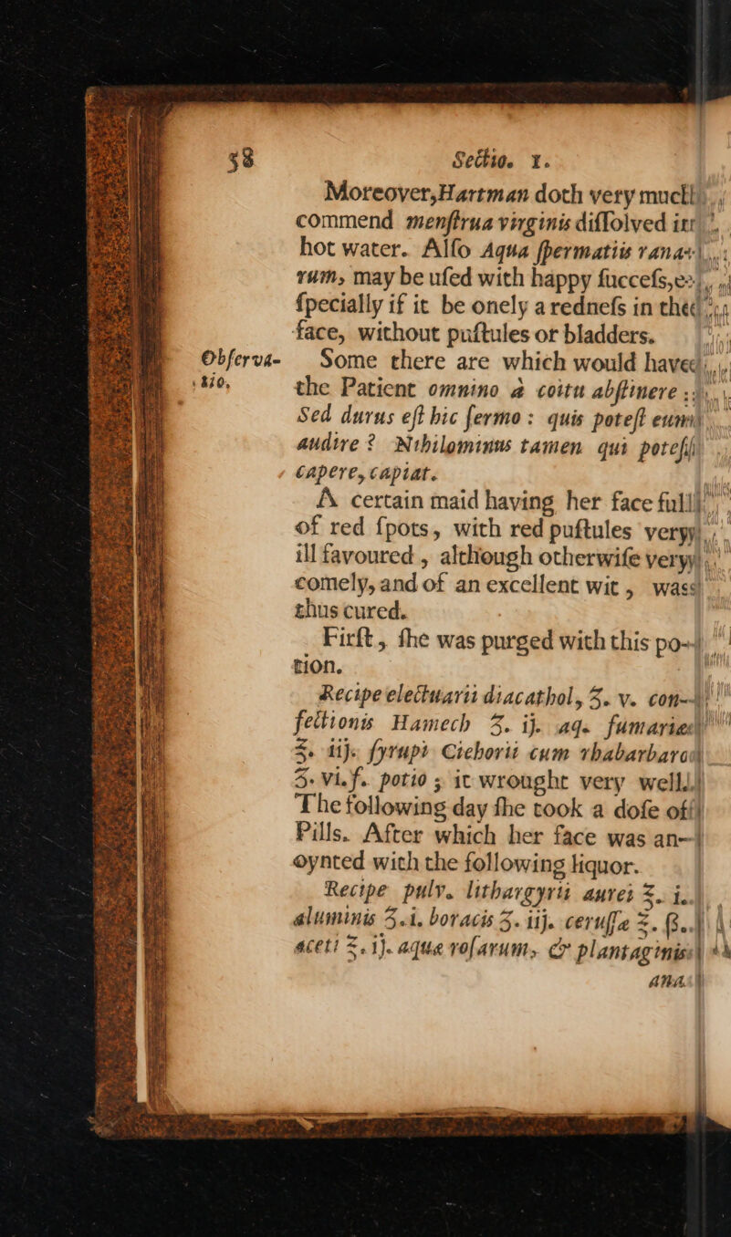 38 Sectio. 1. Moreover,Hartman doth very muctl ._, commend menftrua virginis diffolved itr’, hot water. Alfo Aqua fpermatiis rana+|.,.: rum, may be ufed with happy fuccefs,e2 ,, .; {pecially if ic be onely arednefs in thee *:, face, without puftules or bladders. Obferva- Some there are which would have: 1 80, the Patient omnino a coitu abfiinere ;.. Sed durus eft hic fermo: quis poteft eum) audire? Ntbilominus tamen qui potefii Capere, Capiat. A. certain maid having her face full” of red {pots, with red puftules veryy).;' ill favoured, although otherwife veryy) ,. comely, and of an excellent wit , wass thus cured. Firft,, the was purged with this po-) hon. ) Recipe electwarii diacathol, 3. v. con)! fectionis Hamech 3. ij. aq. fumariad) 3. dijs fyrupt Cichorti cum rhabarbaran 3: Vif. potio ; it wrought very well..! The following day the took a dofe off) Pills. After which her face was an—| oynted with the following liquor. Recipe pulv. lithargyrt aured Z. j..) aluminis 5.1, boracis 3. ij. ceruffe =. Saf 1 aceti 5.1}. aque vofarum, > plantaginiss| 4’ AnAS))