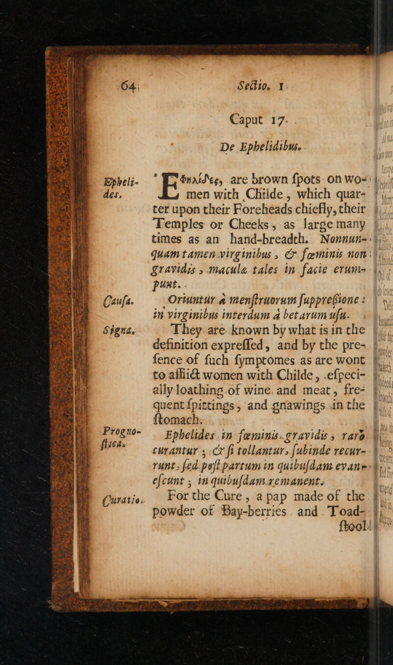 pe Cae? ee « aie eo ‘> 24 Lbs teers Epheli- des. Caufa. Sigua, Progno- fisca. Secio. 1 Caput 17. De Ephelidibus. men with Childe , which quar- ter upon their Foreheads chiefly, their Temples or Cheeks, as large many Sravidis , macula tales in facie erum- punt... _Orwuntur a menfiruorum Jupprebione : in virginibus interdum a betarum ufu. definition exprefled, and by the pre- allyloathing of wine. and meat, fre- quent {pittings, and gnawings..in the ftomach. curantur ; Cr fi tollantur, fubinde recur- efcunt ; in quibufdam-xemanent. For the Cure , a pap made of the powder of Bay-berries and Toad- {tool: