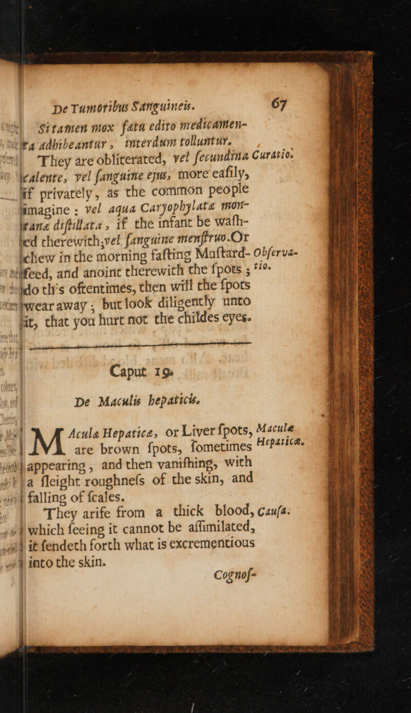 Sitamen mox fata edito medicamen- vita adbibeantur, interdum tolluntur. They are obliterated, vel fecundina Curatio. i. \\ealenre, vel fanguime ejus, more eafily, __ Wf privately, as the common people imagine ; vel aqua Caryophylate mon- wane difiltaca , if the mfant be wafh- ted therewith,vel. fanguine menfrruo.Or ichew inthe morning fafting Maftard- ob/erve- atifeed, and anoint therewith the fpots ; */ i tehdo th's oftentimes, then will the {pots dshwear away, butlook diligently unto lit, that you hurt not the childes eyes. Caput 19. De Maculis hepatice. “| Acula Hepatice, or Liver fpots, Macule 1 | are brown fpots, fometimes vw) appearing , and then vanifhing, with va fleight roughnefs of the skin, and uy} falling of {cales. They arife from a thick blood, caufa: ,) which feeing it cannot be affimilated, wil it fendeth forth what is excrementious 4 into the skin. Cognof- Phy See By, OS