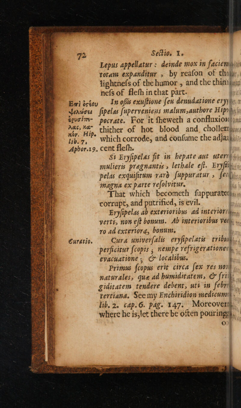 q2 Setti0e Ye Lepus appellatur: deinde mox in faccetig\y) totam expanditur , by reafon of thi) lighcnefs of the humor , and the chinijyiy nefs of flefh in that part. | Eaiicioy In ofsis exuftione fen denudatione eryy ex, sfeadoee fipelas {uperveniens malum,authore Hippos | eguoim- pocrate. For it fheweth a confluxioni) jim/ ae Hip. thither of hot blood and, chollettpjy; lib.7, | Which corrode, and confume the adjaayji\: Aphor.x9. cent fleth. | St Evyfipelas fit in hepate aut uterr) mulieris pragnantes lethale eft. Eryftipi:(y pelas exquifitam raro fuppuratur , feel magna ex parte refolvitur. i, That which becometh fuppurated),,) corrupt, and putrified, 1s evil. ' Eryfipelas ab extertoribus ad interiori\y, verti, non eft bonum. Ab interiortbus vee) , vo ad exteriora, bonum. | Curatio. Cura univer{alis eryfipelatis tvibsi,,, perficirur fcopis ; nempe refrigerattonecy, evacuatione - c> localibus. ) Primus fcopus erit circa fex res noo naturales, que ad humiditatem, &amp; fri), giditatem tendere debent, utt in febri,. tertiana. See my Enchividion medtcumy , lib. 2. cap.6. pag. 147. Moreoversh where he is,let there be often pouring}, ° 0 eR