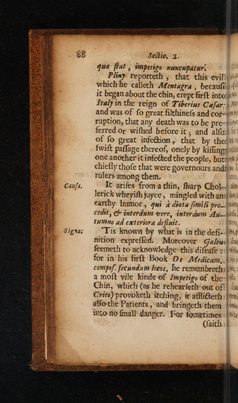 Caufa. Signas Seti, 3. que flat, impetigo nuncupatur: Pimy reporteth , that this evil! which he calleth Afentagra , becaufe 4 it began about the chin, crept firft inteo i Italy in the reign of Tiberius Cafar:) Mi and was of fo great filthinefs and cor--\i!! ruption, that any death was to be presi ferred or wifhed before it ; and alfa) ii of fo great infeGion, that by thed thi’ {wift paflage thereof, onely by kiffings) iit! one another it infected the people, buttliW/ chiefly thofe that were governours andiiii | rulers-among them. i It arifes froma thin, fharp Chol) it lerick wheyith juyce, mingled with ani} earthy humor, gui adieta fimilk pro—\iil cedit, &amp; interdum vere, interdum An-\ili tuMino ad exteriora defluit. Bien “Tis known by what is in the defj--{\¢ nition exprefled. Moreover Galews| lw feemeth to acknowledge: this difeate Wich for in his firft Book De Medicam,. wh) compel. fecundum locos, he remembreth yi, a moft vile kinde of Impetigo of the) Chin, which (as he rehearfeth out off) x Crito) provoketh itching, i affliGterk | | iin alfo-the Patients , and bringeth them | | ity into no {mall danger. For fometimes.: } {i (faich.: |