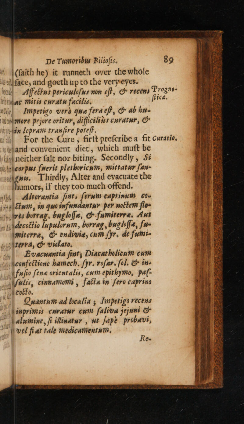 \(faith he) it runneth over the whole ‘beiface, and goeth up to the verpeyes. thigkac mites curate facilis. We) Impetigo verd qua ferach, &amp; ab hn- ‘nlumbamore pejore oritur, difficilins curatur, &amp; beedin lepram tranjire poreff. land convenient diet, which muft be y iii) neither falt nor biting. Secondly, S¢ ie nleorpus frerit plethovicum, msttatur fan- oigues. Thirdly, Alcer and evacuate the Tord if they too much offend. Athi dserantia fiat, fernm caprinum Co= \ijahttwmn, in quoinfundantur per noctem fle sty bres borrag. baglf[e, &amp;fumirerra. Ant . 4, pdecottio Lupulorum, borrag, bughffe, fae \mirerra, &amp; endivia, cum yr, de fumt- Ln iterra, &amp; violato, cy) Evacuantia fint; Diacatholioum cum ».\confettione hamech, [yr. rofar. fol. &amp; ine atfufio [ene orientalis, cumepithymo, paf- atfales, cinnamom , falta in fero caprino “\ bC0EEO. | Quantum ad localia ; Impetiga recens \\inprimis curatur cum faliva jejuni &amp; “\alumine, fi illinatur , wt fepe probavi, vel fiat tale medicamentum, Rew Bin ean ape nn com — etn ta = e feet Jie ~aapmesiiitaien Fleer Neat A hn Se URBAN. Napa