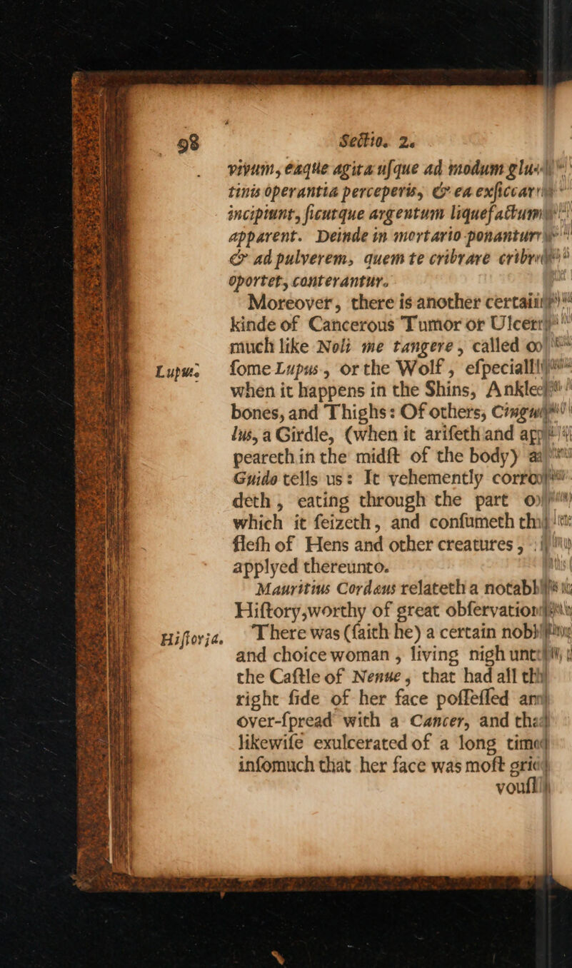Sat finn 1 Fanta on 9 Jo Tn ANCE | gege ee i s opr ots De 6, te Te 4 ot eerie o AY ar ae ra ss >. x wr va ee he * a ge re a. 7 ern ee eae - oe “4 , s as Sectio. 2. vivum, eaque agita ufque ad modum glus\ tinis operantia perceperis, ea exficcarry incipiunt, ficutque argentum liquefattum': apparent. Deinde tn mortario-ponantury' c> ad pulverem, quem te cribrare ertbri* Oportet, conterantur. 4 Moreover, there is another certain?) kinde of Cancerous Tumor or Ulcerry:” much like Noli me tangere , called oo) fome Lupus, or the Wolf , efpecialli™ when it happens in the Shins, Anklee}™: bones, and Thighs: Of others, Cemgaiym' lus, a Girdle, (when it arifeth and agp!‘ peareth in the midft of the body) aa Guide tells us: It vehemently corroy deth , eating through the part op// fiefh of Hens and other creatures , © ij!\) applyed thereunto. | Mauritius Cordaus relateth a notabbié it Hiftory,worthy of great obfervation|s\ There was (faith he) a certain nob}iFiny and choice woman , living nigh untehti; | the Caftle of Nenue, that had all thy right fide of her face poffefled annl over-{pread’ with a Cancer, and the) likewife exulcerated of a long timed infomuch that her face was moft gri«} voufli)